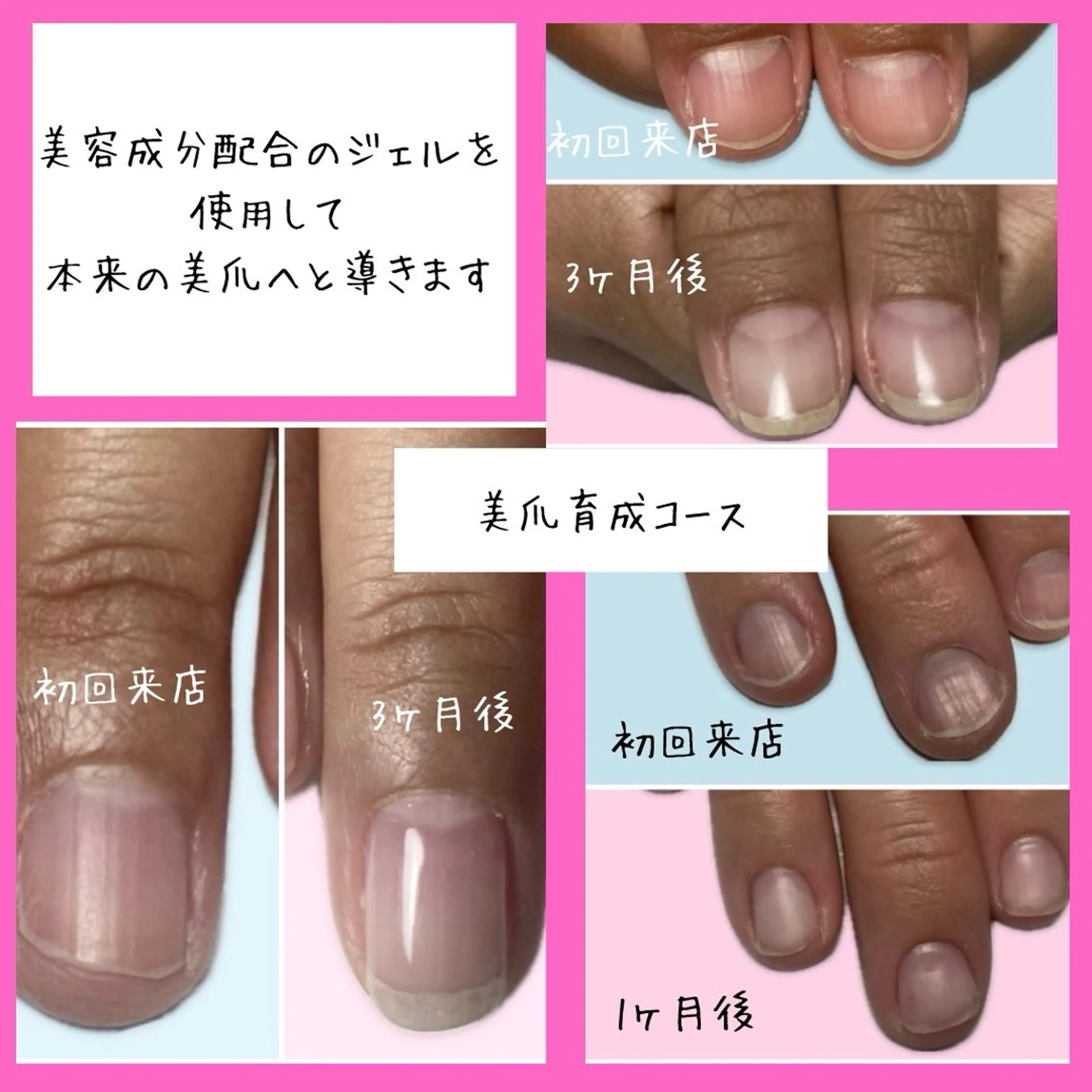 ネイル Briller Nail所属・Briller Momo by Bのエステ・リラクイメージ