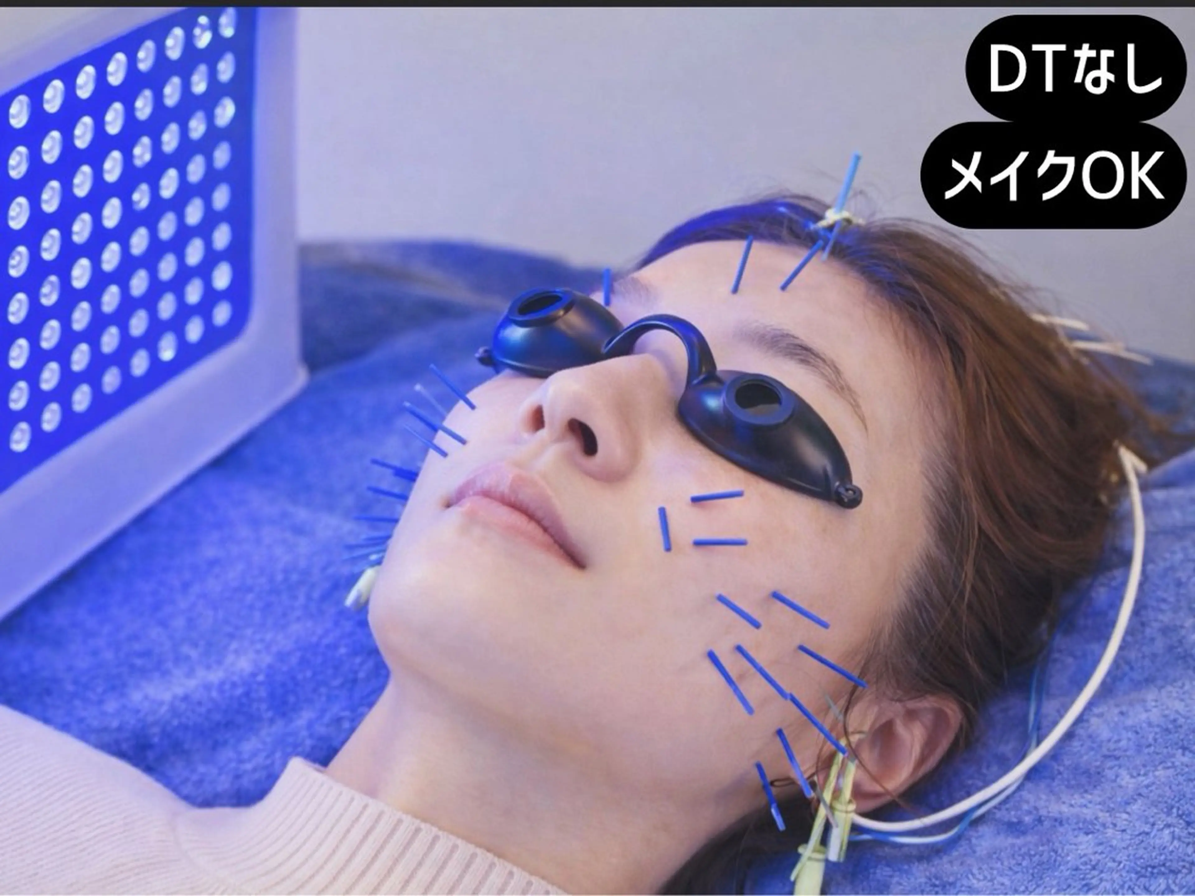 【毛穴・ニキビ/肌育】4色LED×美容鍼EMSで透明感UP 60分の写真