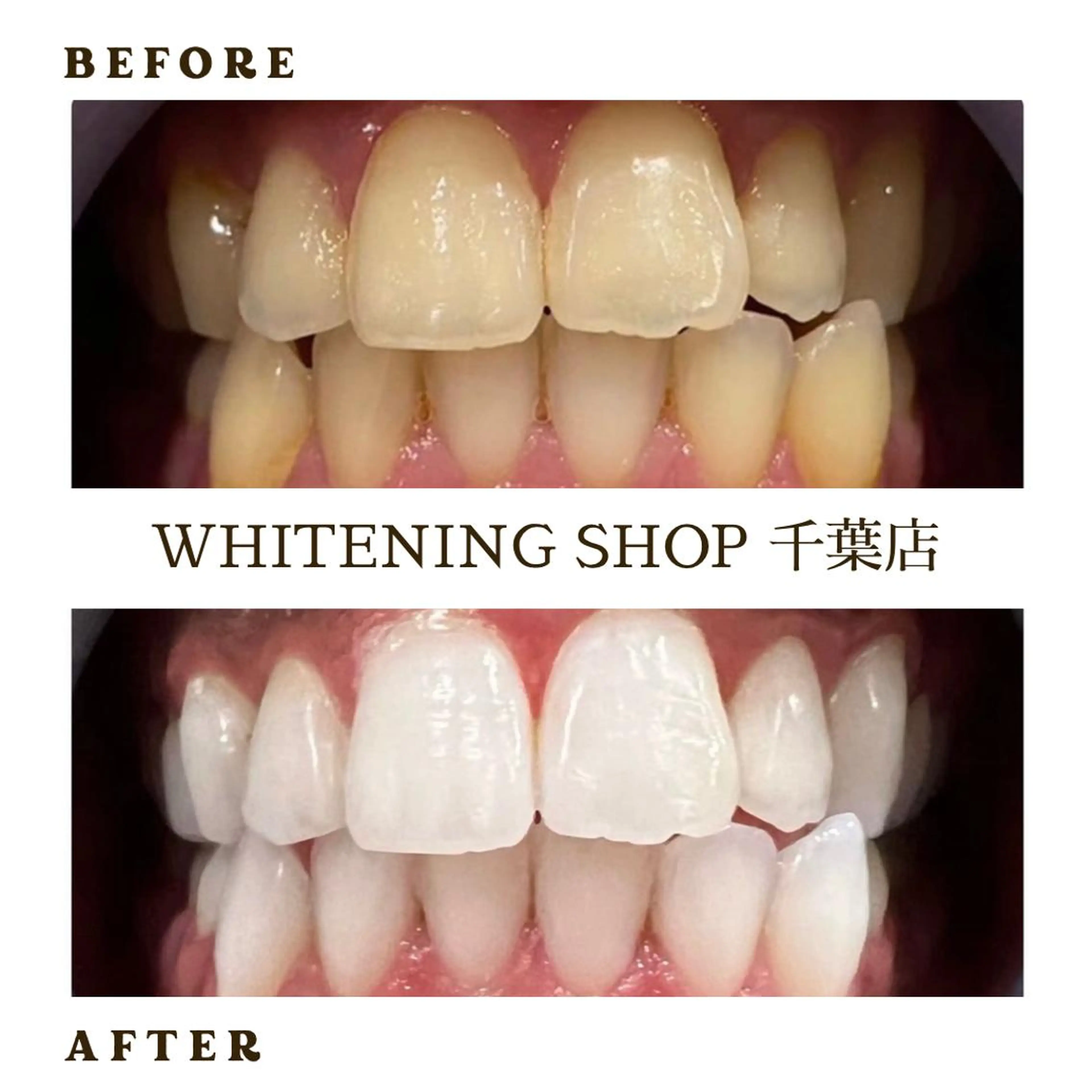 メンズ ホワイトニング ショップ千葉店のその他イメージ