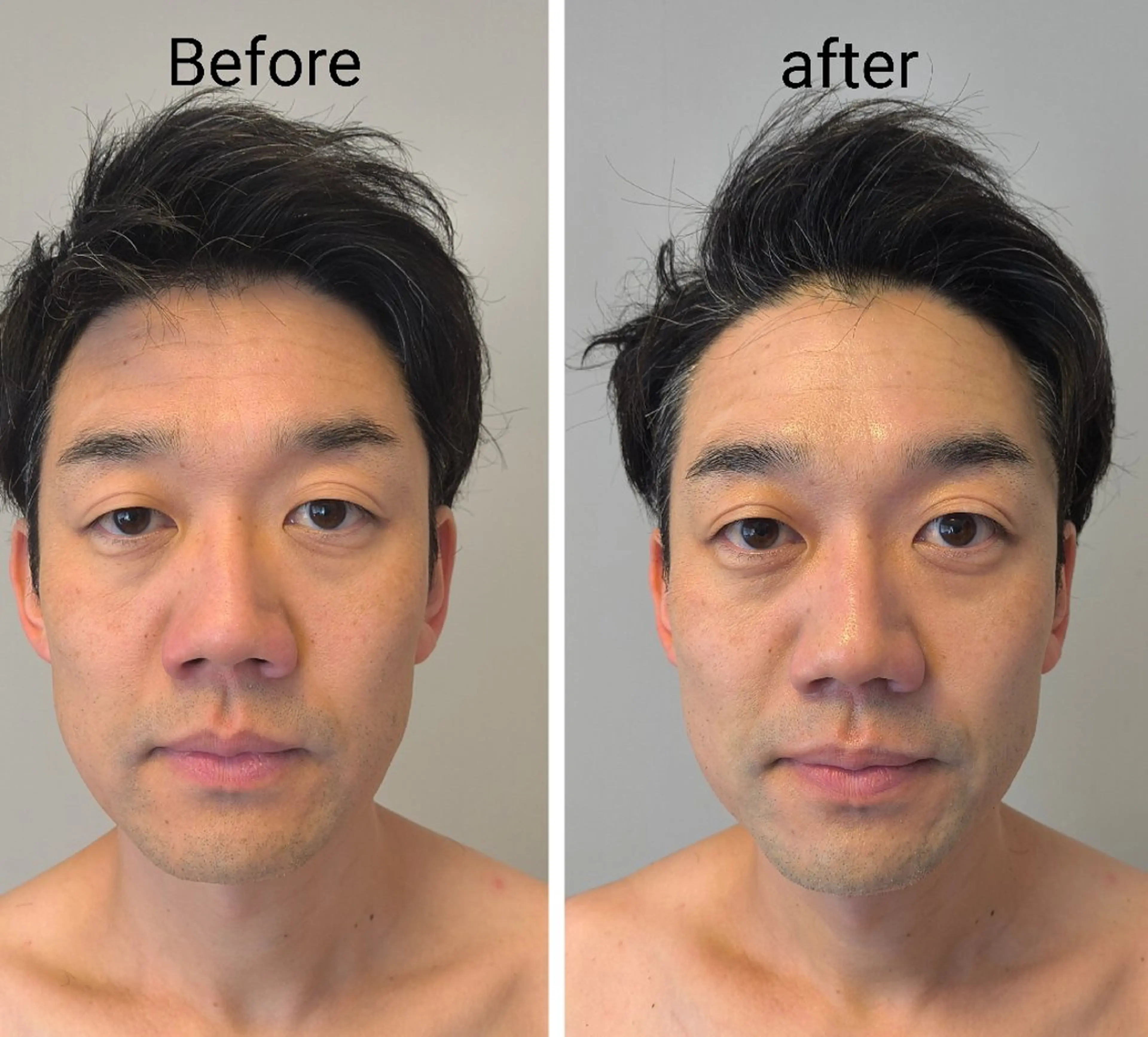 メンズ ECLAT所属・プライベートサロン✢ Eclatエクラ　のエステ・リラクイメージ