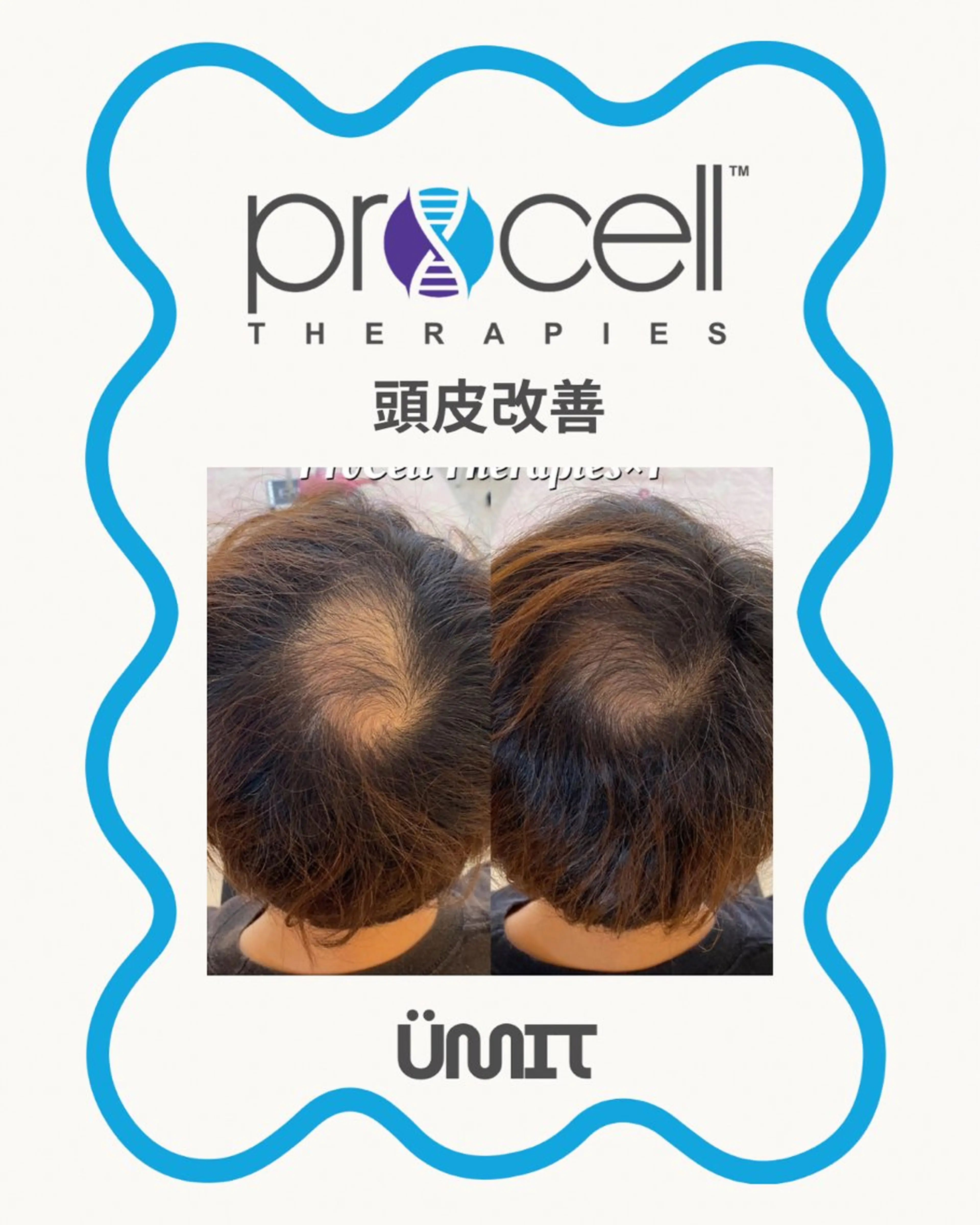 メンズ ヘッドスパ Ümit（ユミト） プロセルセラピーズのヘアスタイル