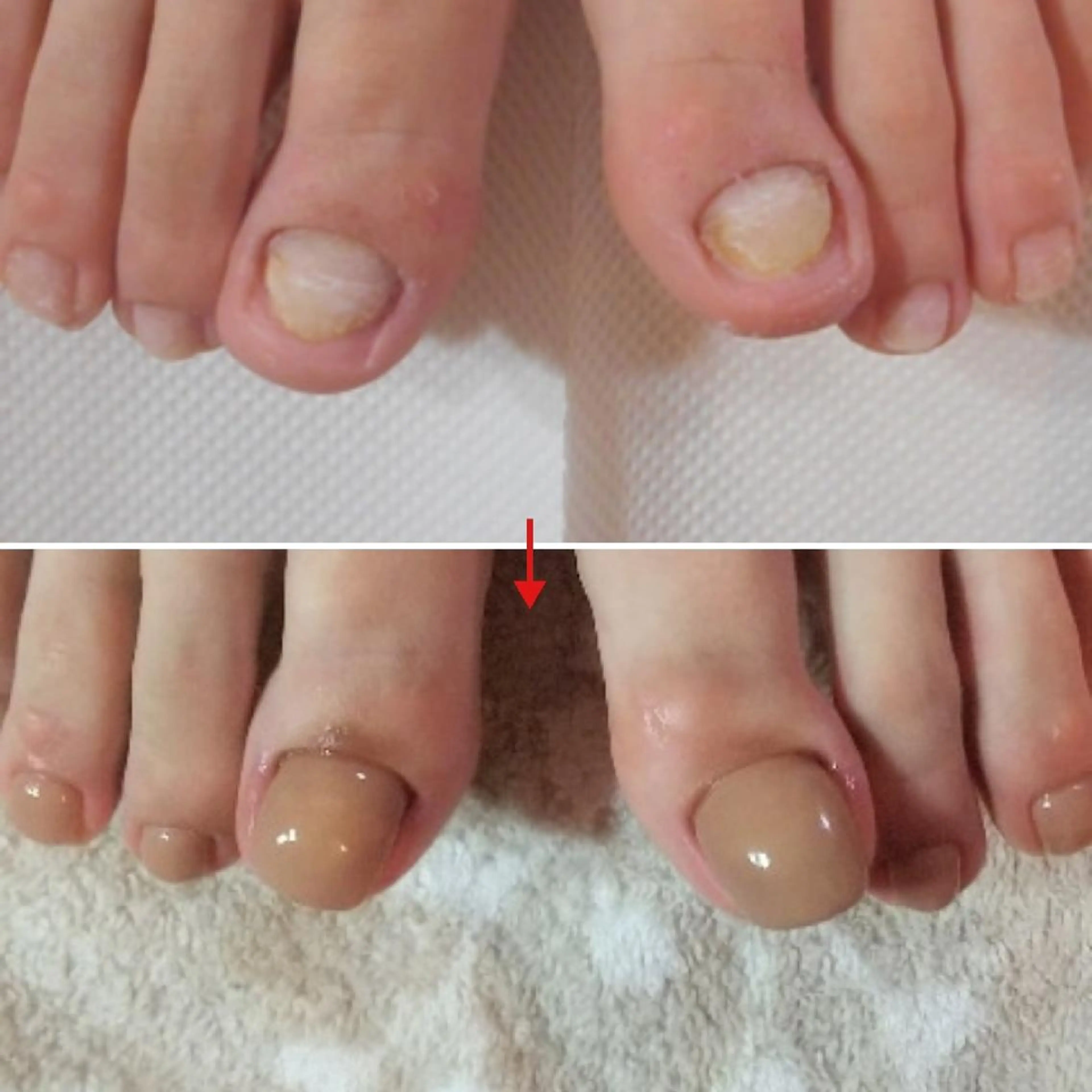 ネイル フットネイル ネイルサロンアリューム所属・ネイルサロン アリュームのネイルデザイン