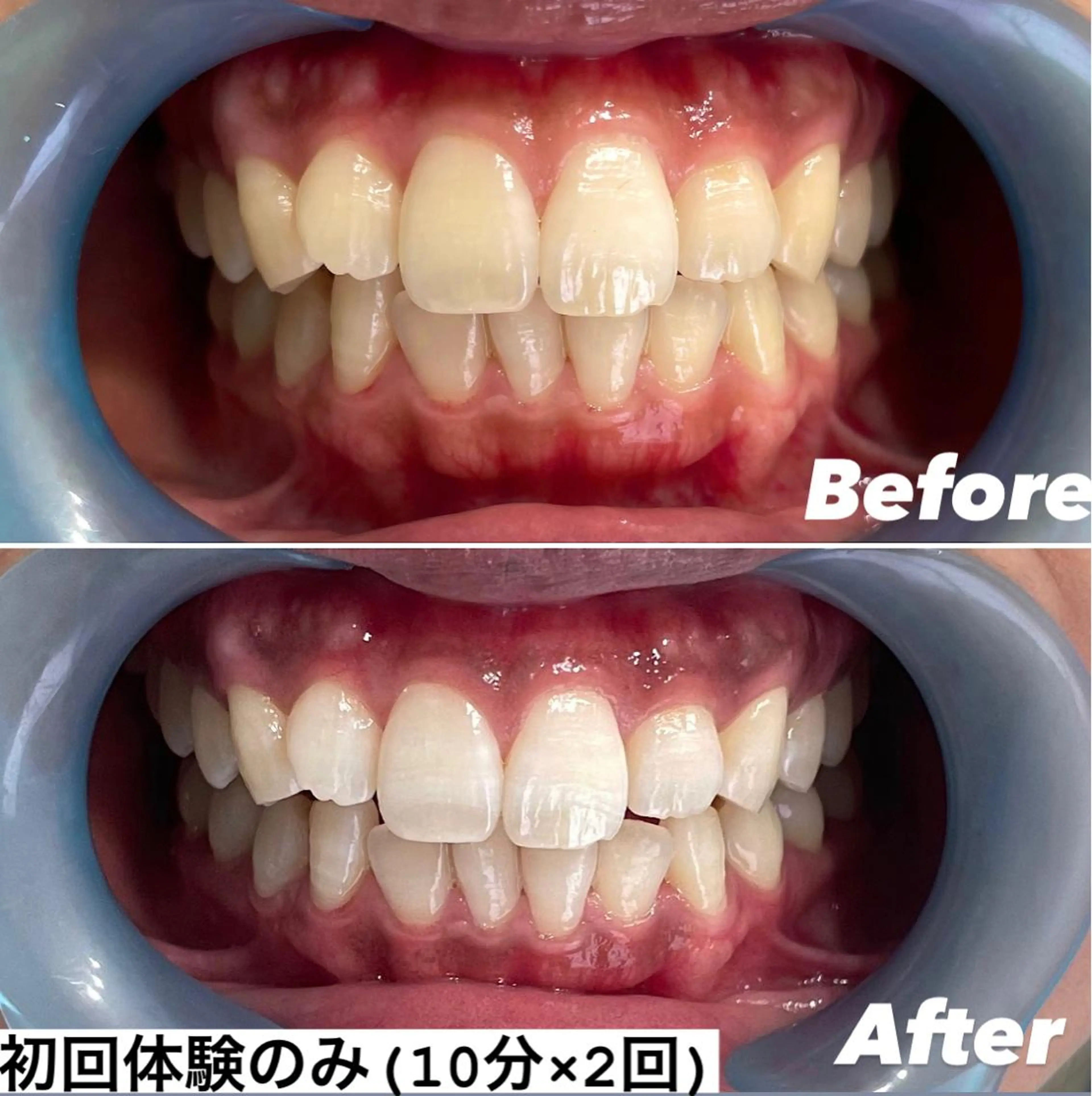 その他 ホワイトニング専門店 Hi-Whiteのその他イメージ