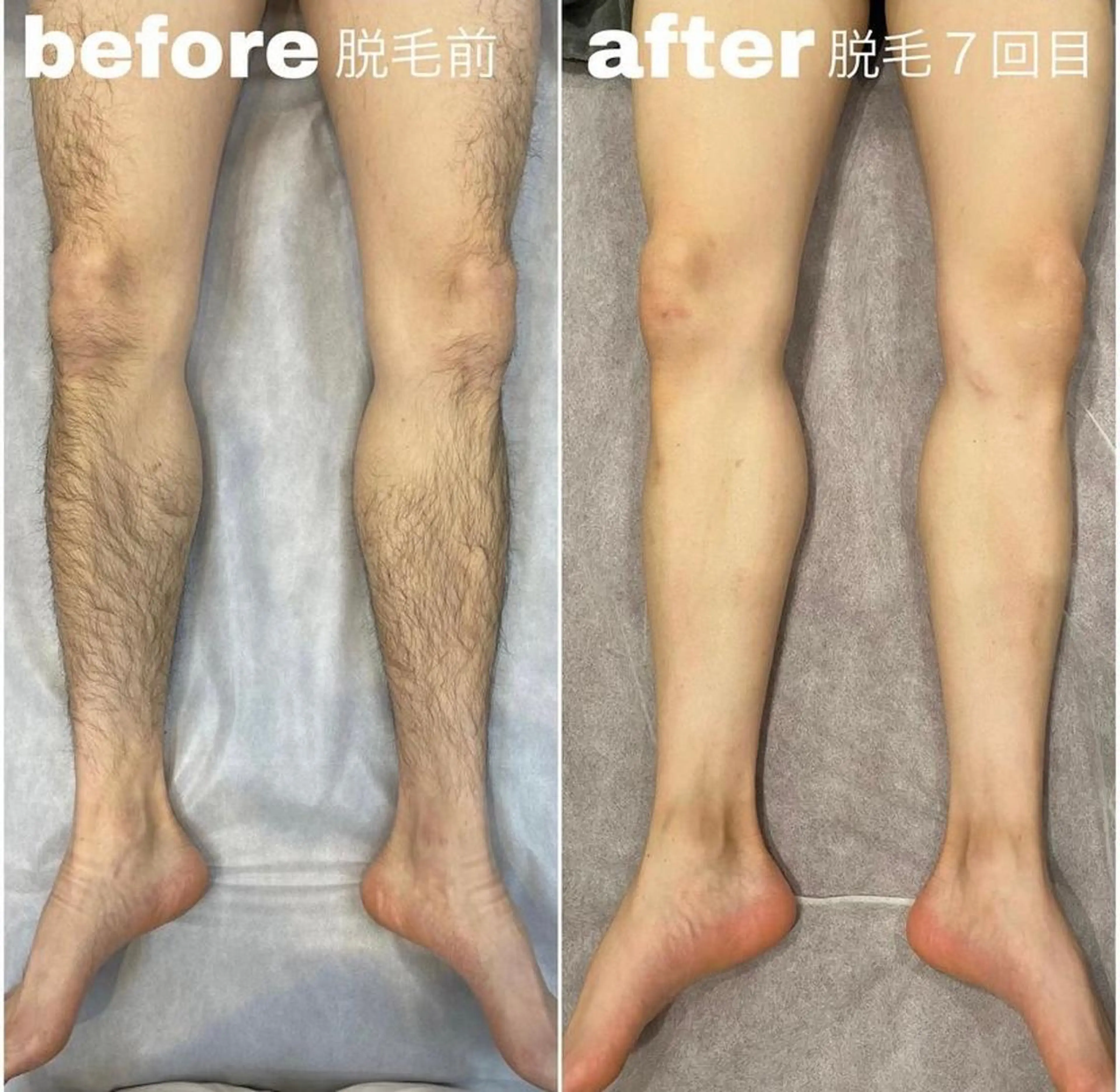 メンズ 脱毛 Ikuta Youの眉毛・アイブロウイメージ