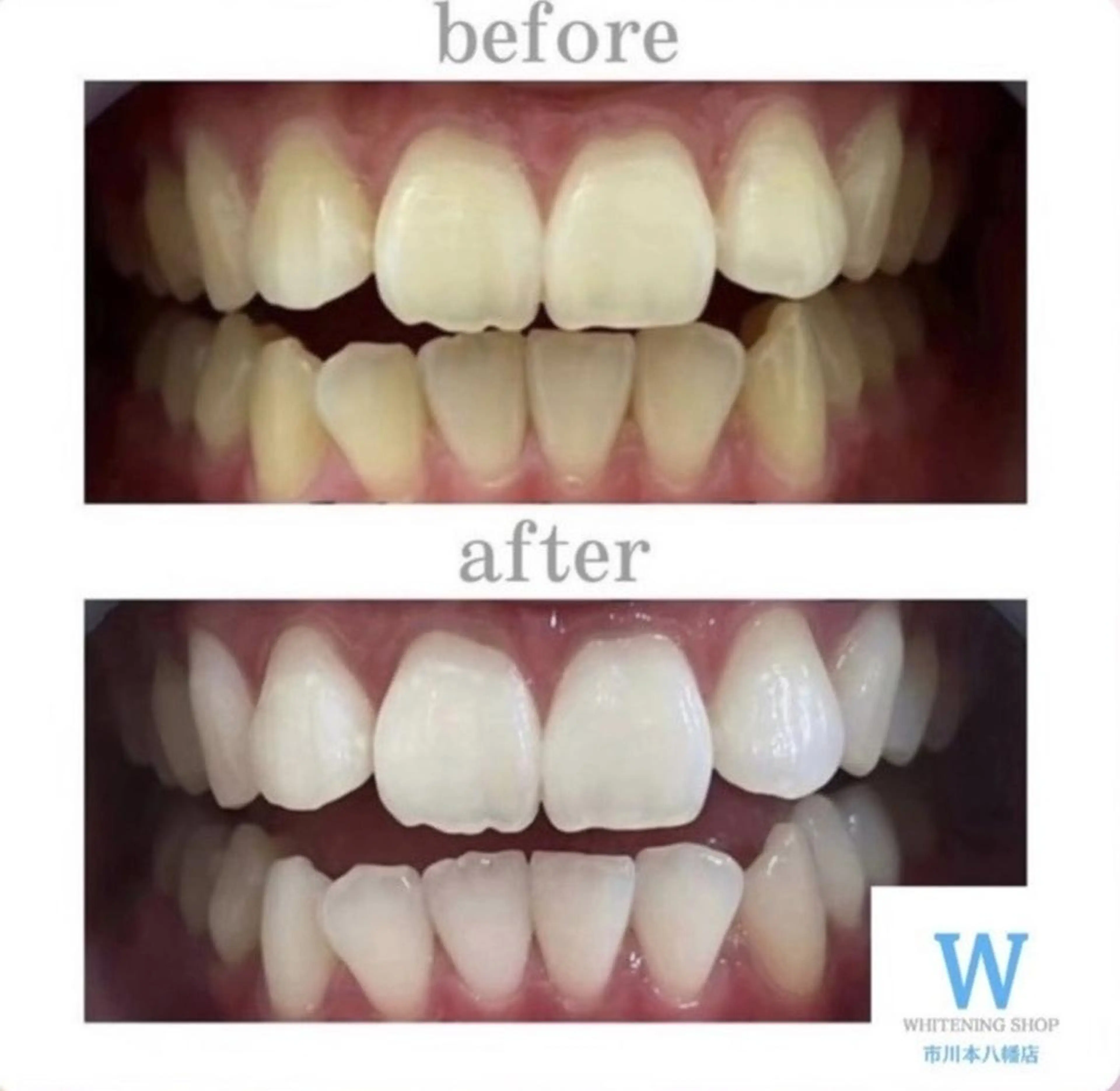 メンズ エステ リラク ホワイトニング ショップ本八幡店のエステ・リラクイメージ