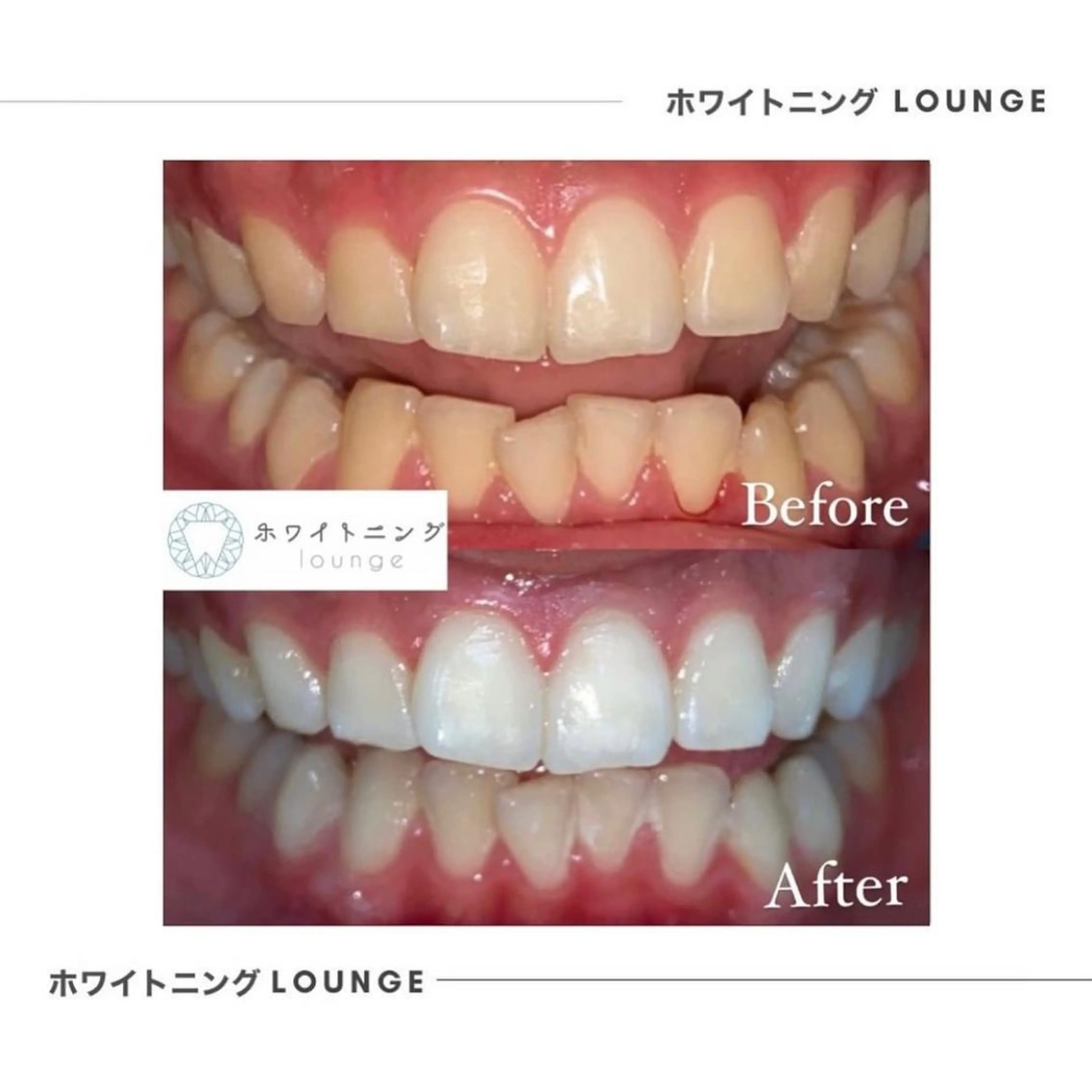 ホワイトニングラウンジ横須賀所属・ホワイトニング Lounge横須賀のその他イメージ