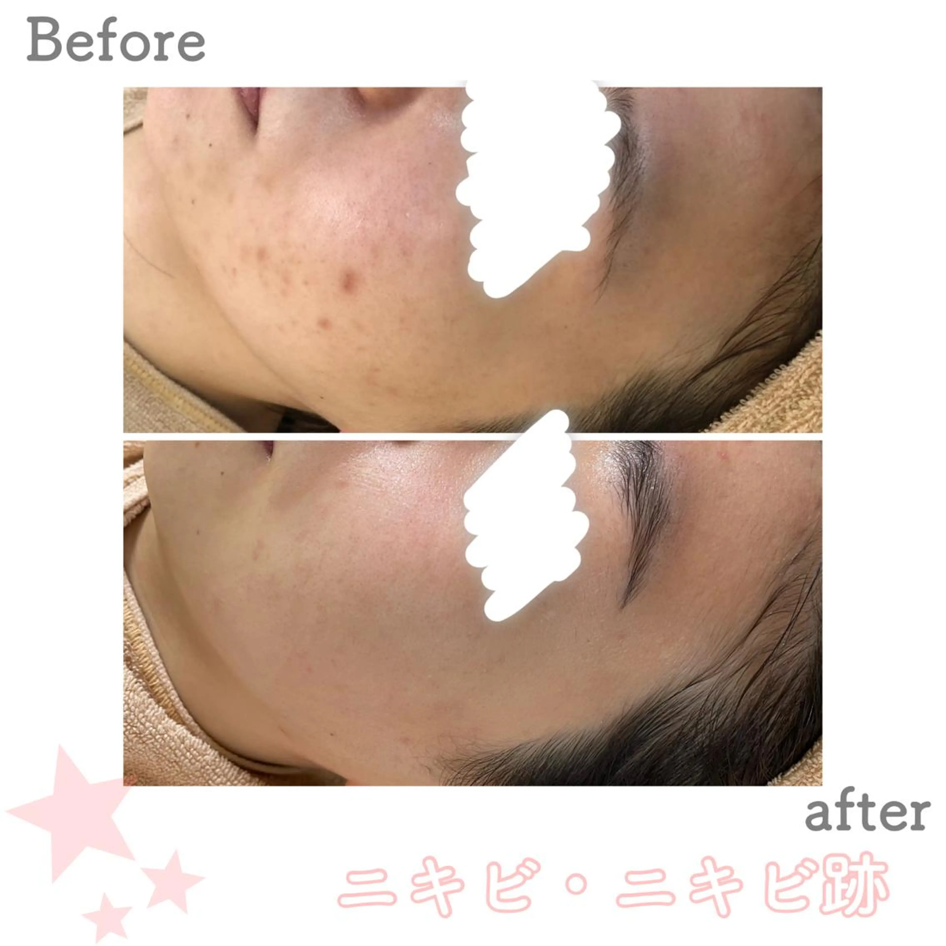 ミディアム カラー パーマ ヘアアレンジ メンズ キッズ ネイル マツエク・マツパ エステ ニキビ&跡改善サロン オーナー光木のエステ・リラクイメージ