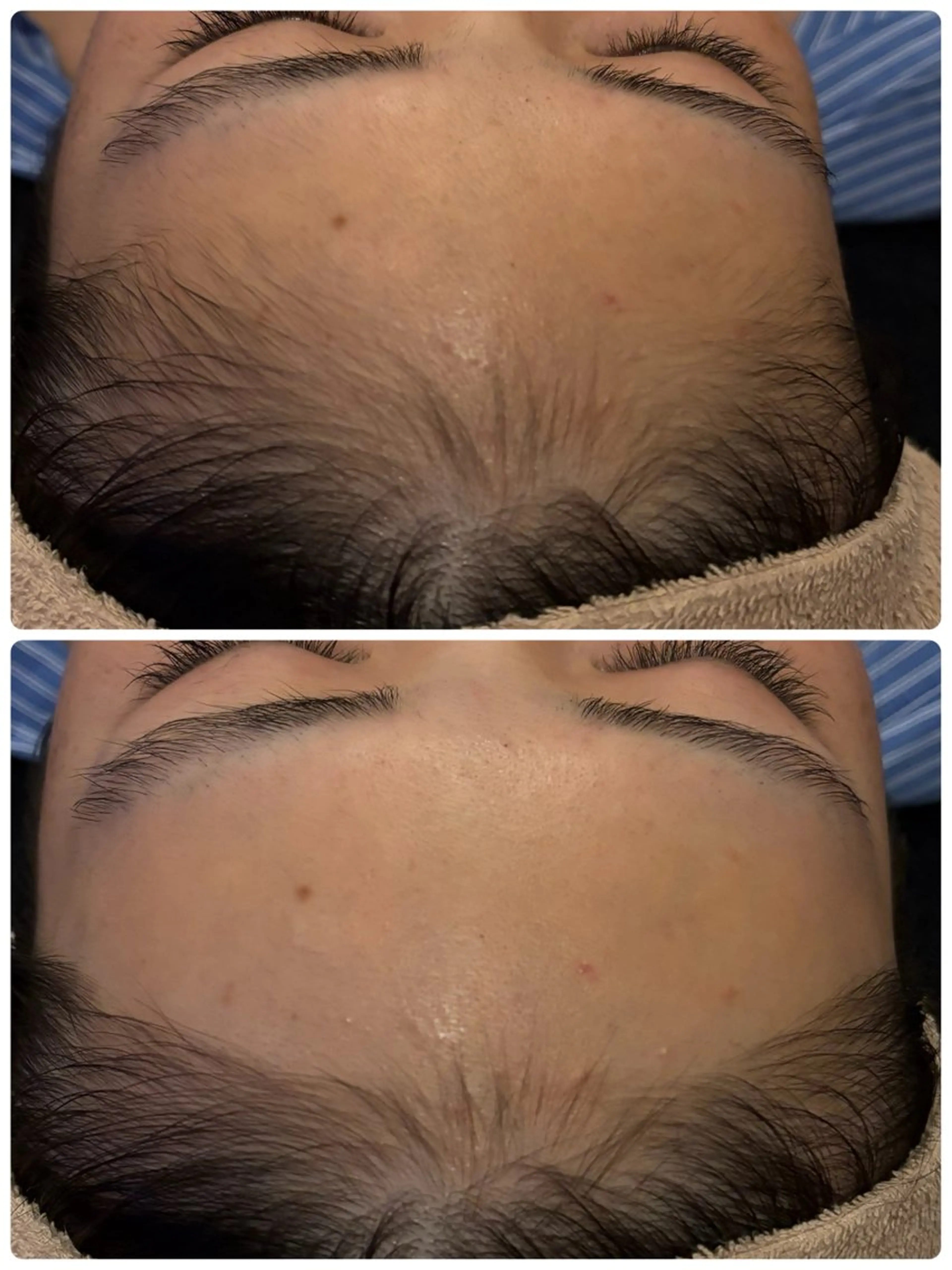 脱毛 【リベルハーブピーリング認定店】敏感肌・美白脱毛専門店Dione立川店所属・Dione 立川店のエステ・リラクイメージ