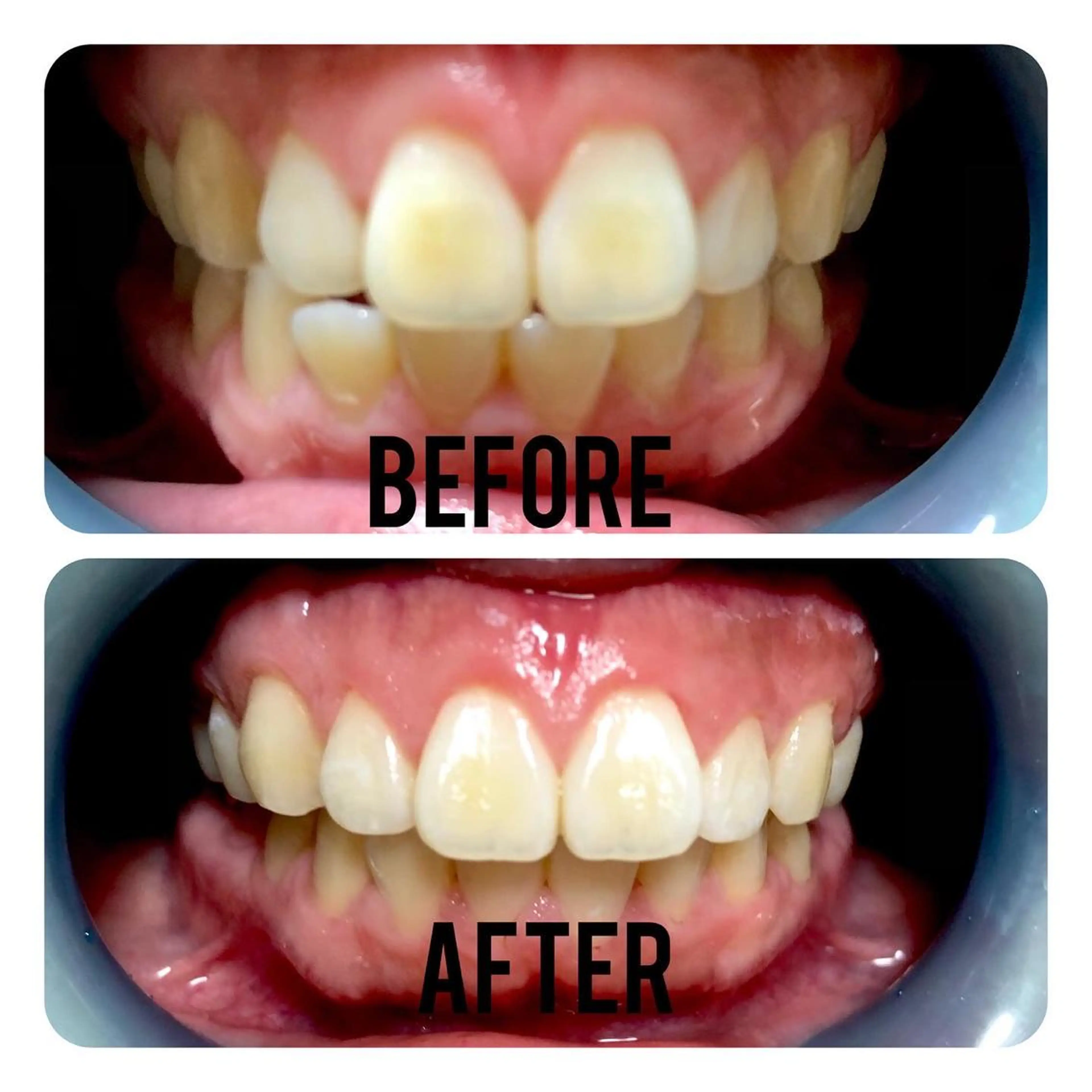 その他 two nailのネイルデザイン