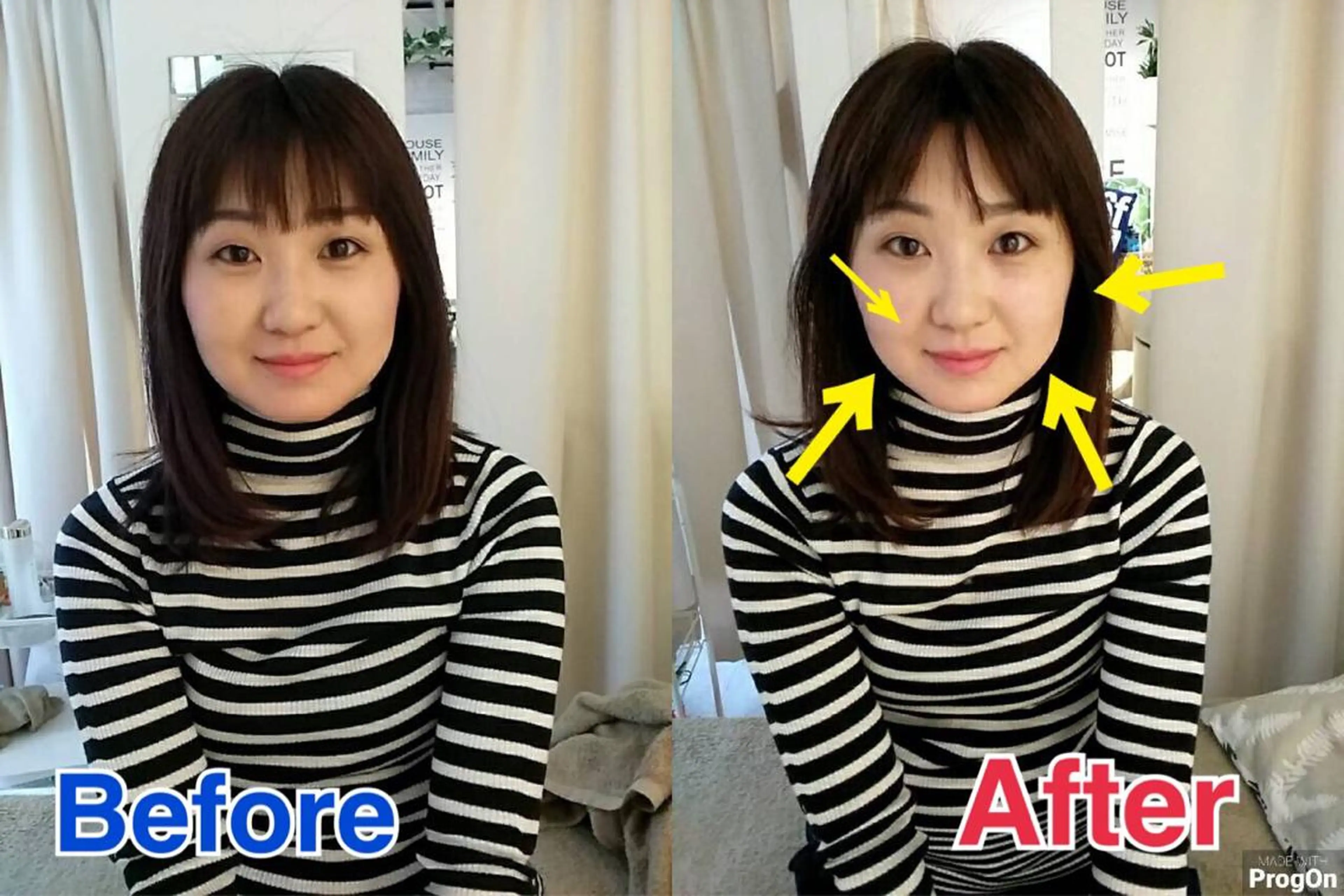 鍼灸整骨院Refine所属・鍼灸 Refineのその他イメージ