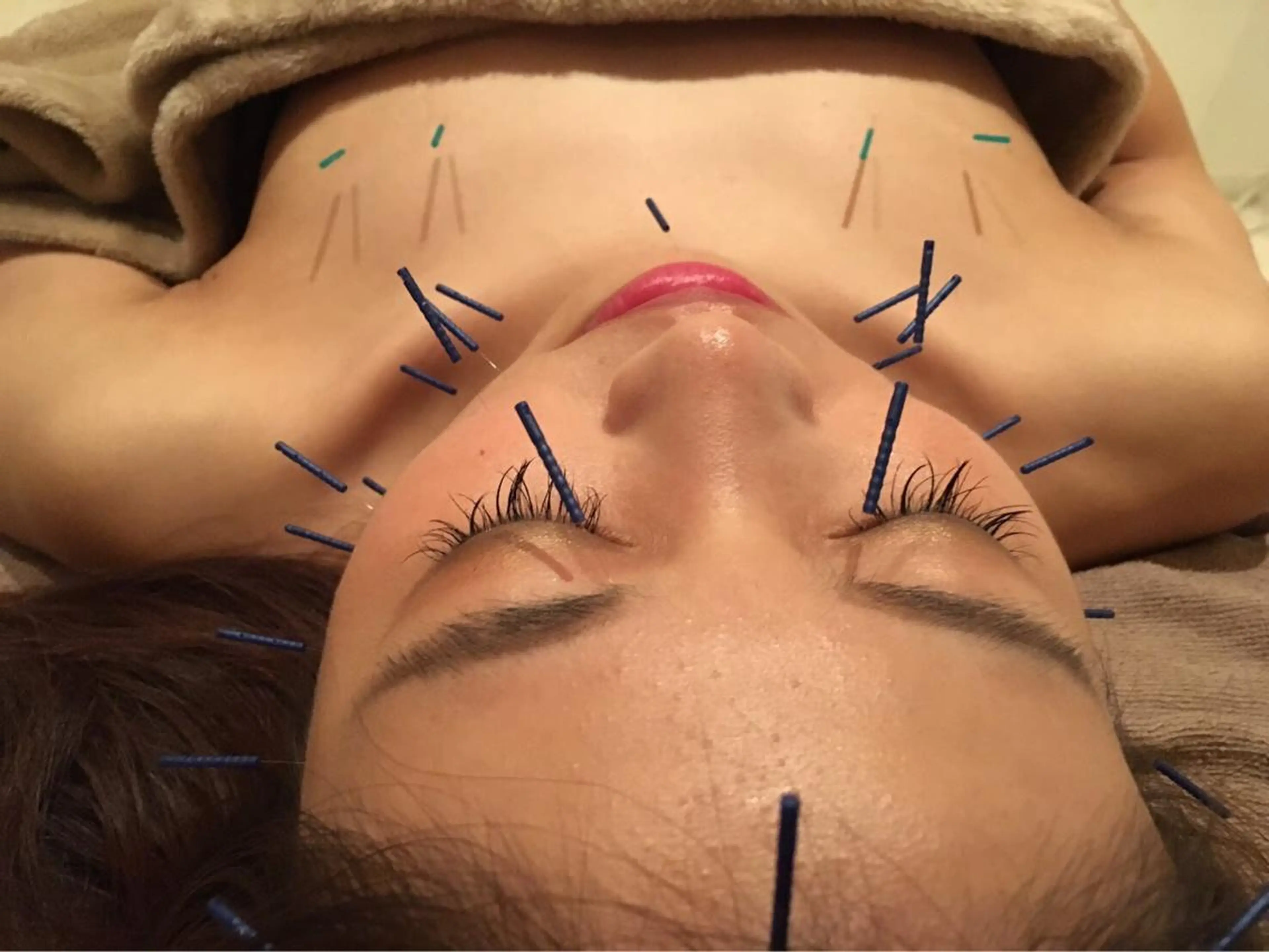 美容鍼サロン    Fleurir所属・伊藤 かなえのエステ・リラクイメージ