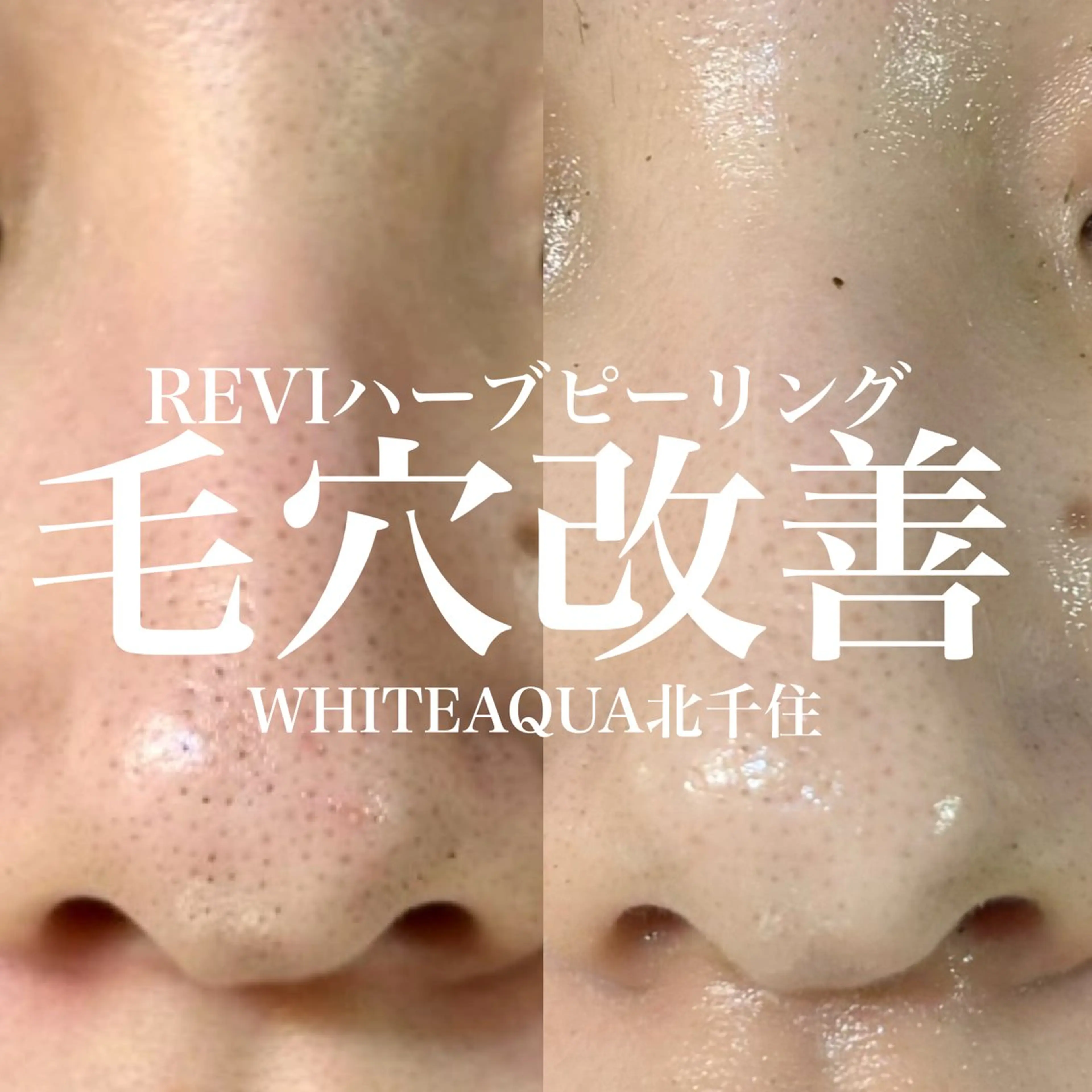 エステ WHITE AQUA 北千住店のエステ・リラクイメージ