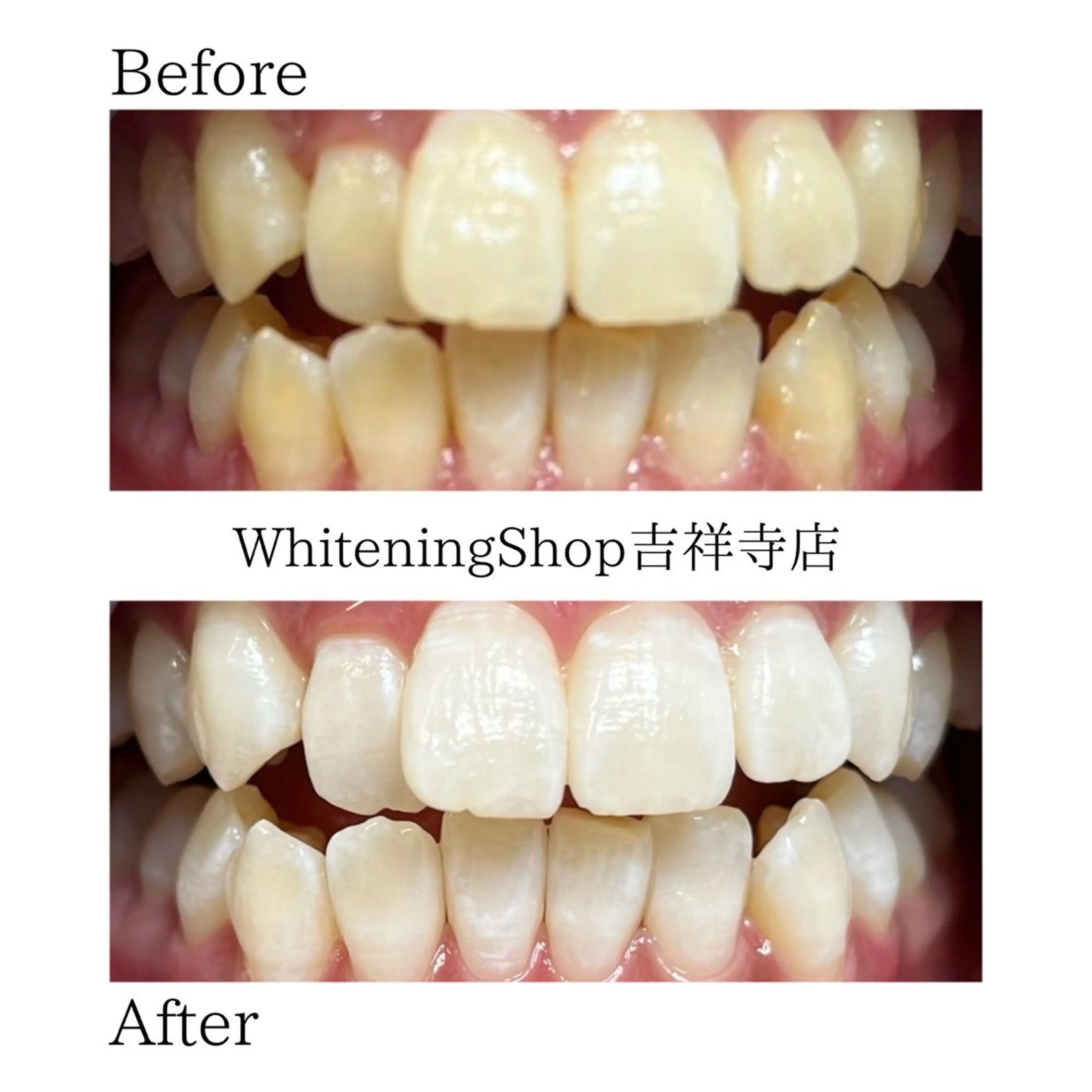 エステ リラク ホワイトニング ショップ吉祥寺店のエステ・リラクイメージ