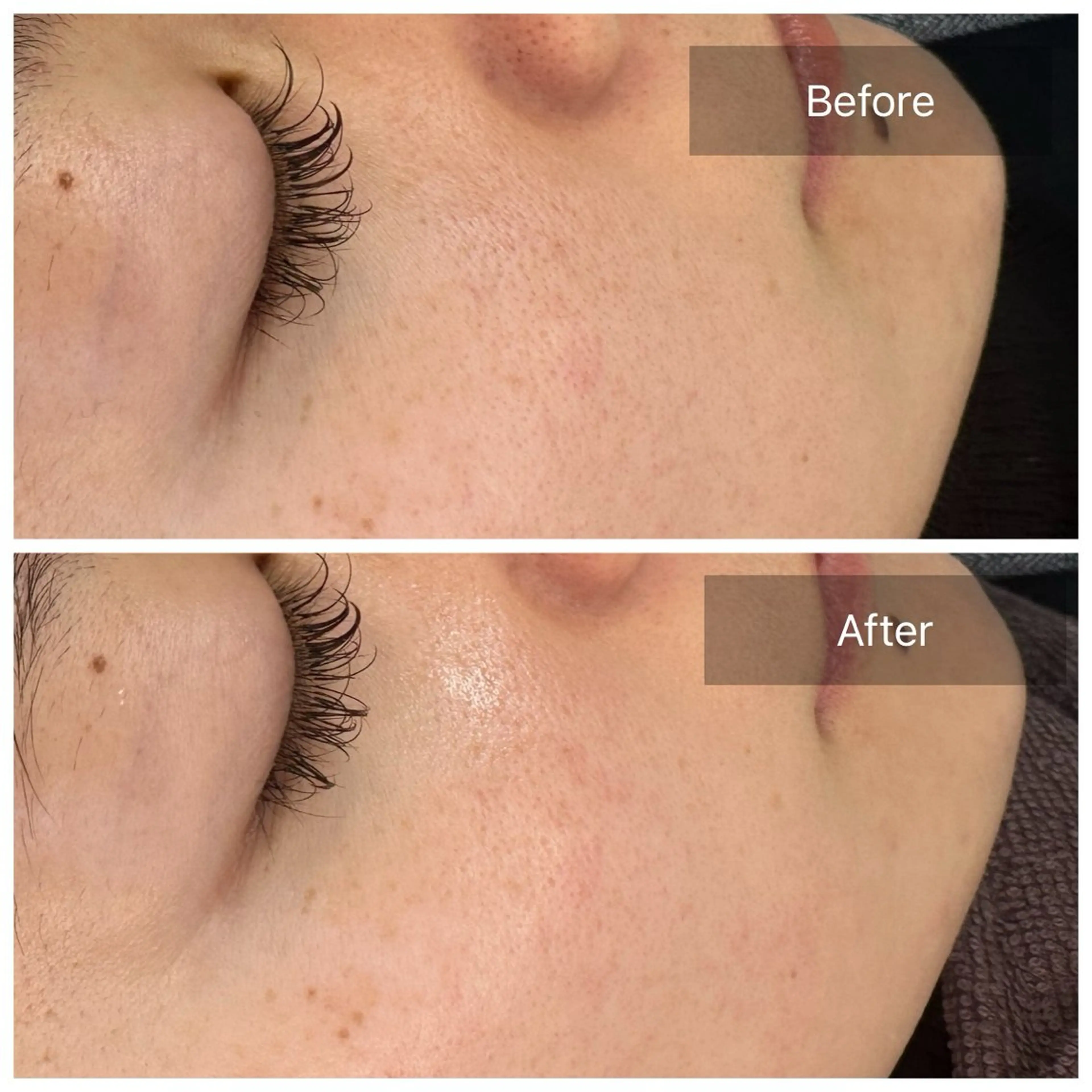 エステ トータルしみケア専門 NICA(ニカ)のエステ・リラクイメージ