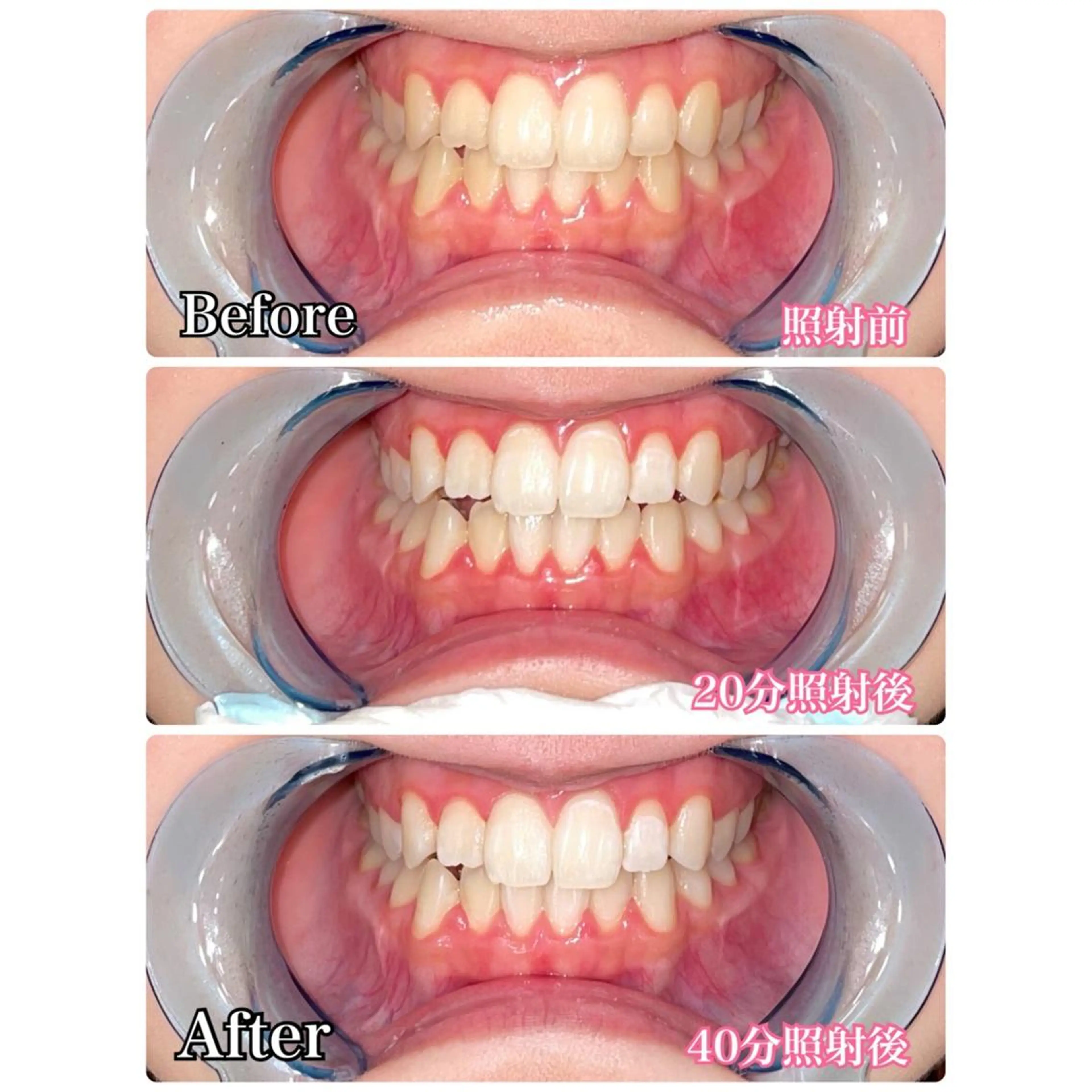 その他 ☆専門店にお任せ☆ ホワイトニング吉祥寺のその他イメージ