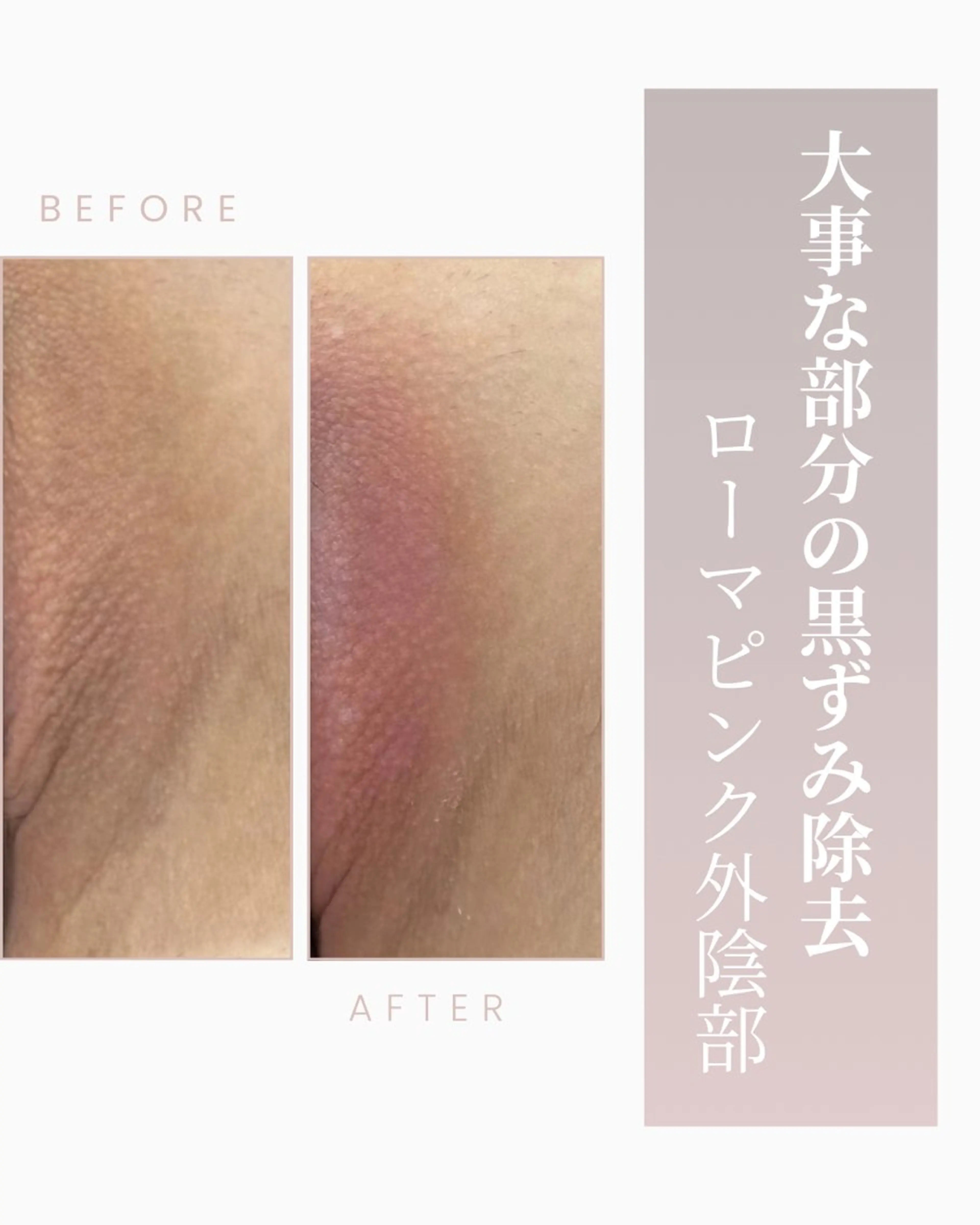 本気で痩せたい方へ 痩身専門サロンのエステ・リラクイメージ