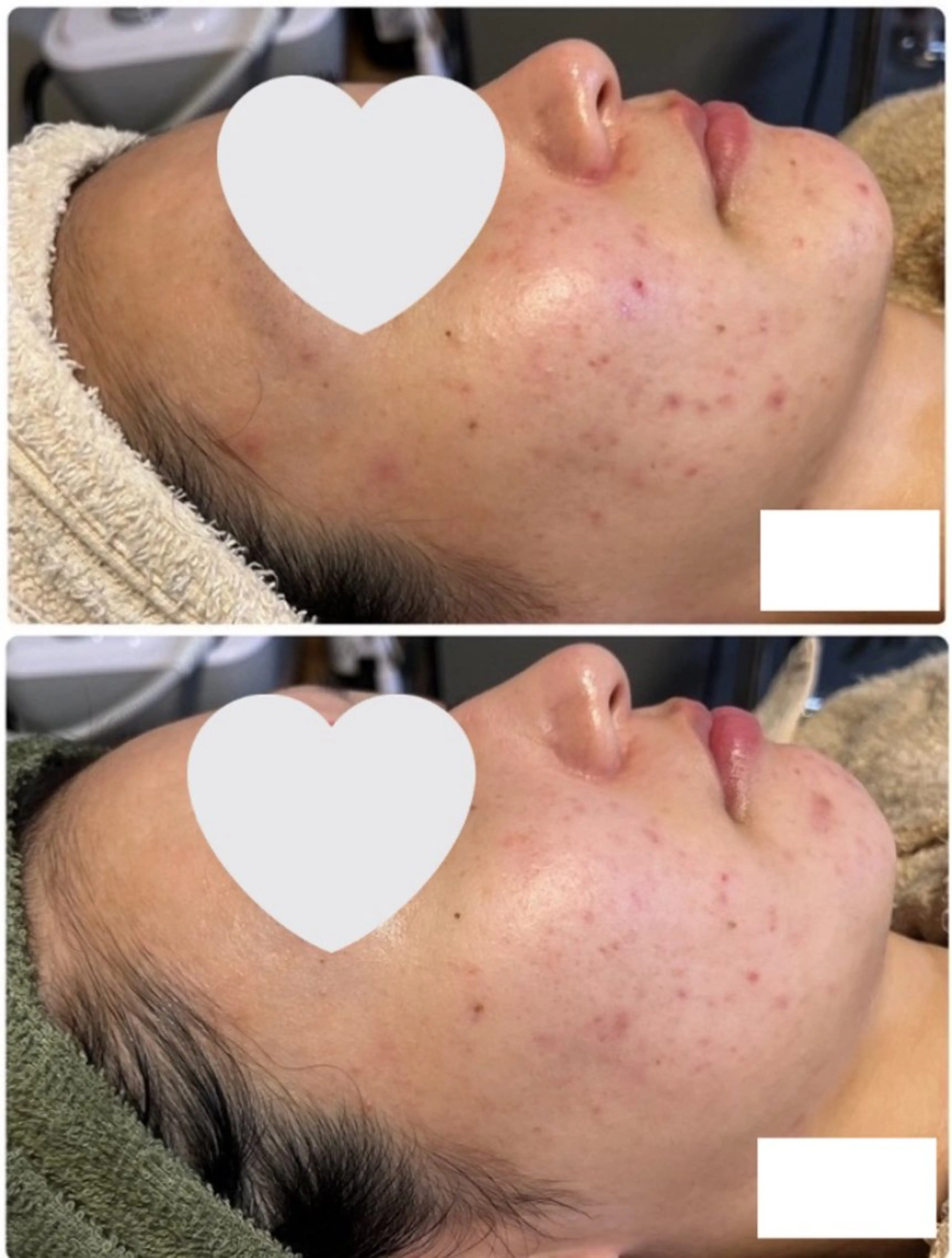 エステ リラク ピーリング専門店 Belluteのエステ・リラクイメージ