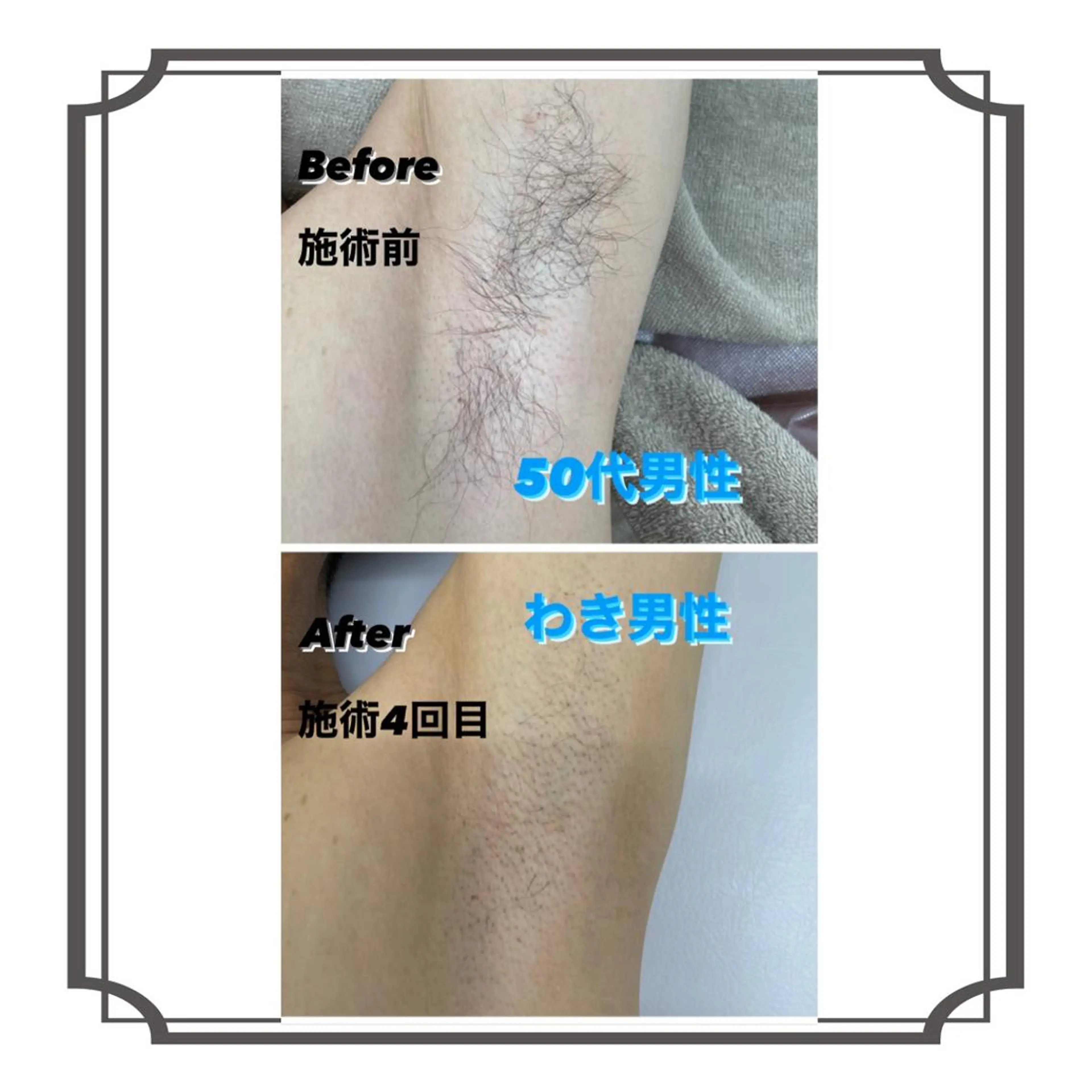 メンズ ホワイトニングサロン プレジールのエステ・リラクイメージ