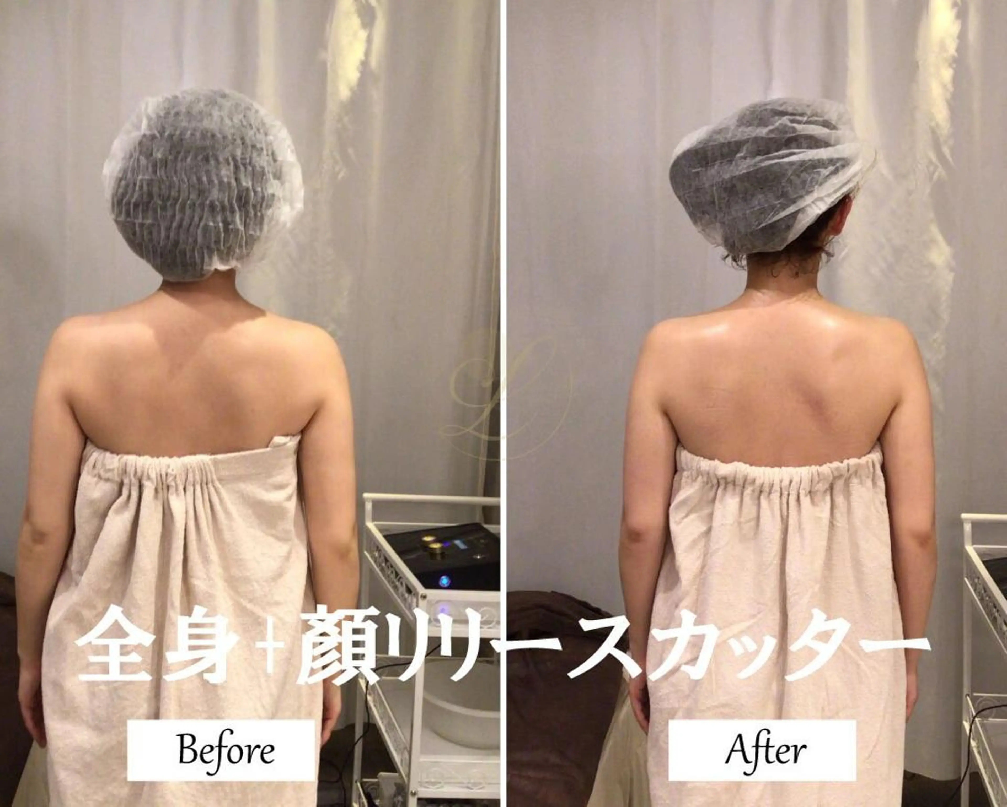 ブライダルサロン |Lino【堀江】のエステ・リラクイメージ