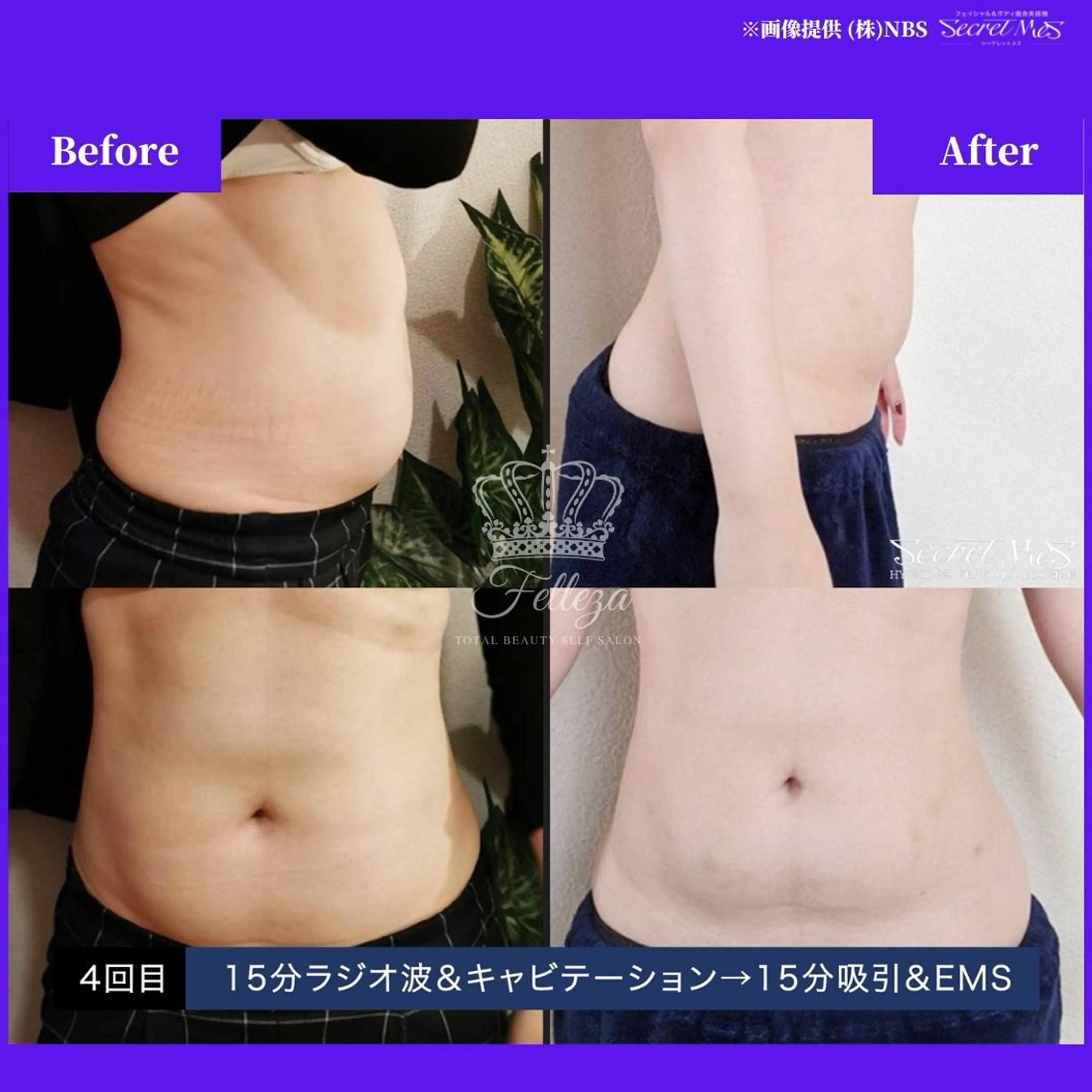 メンズ 有人型セルフサロン 脱毛/痩身/美顔のその他イメージ