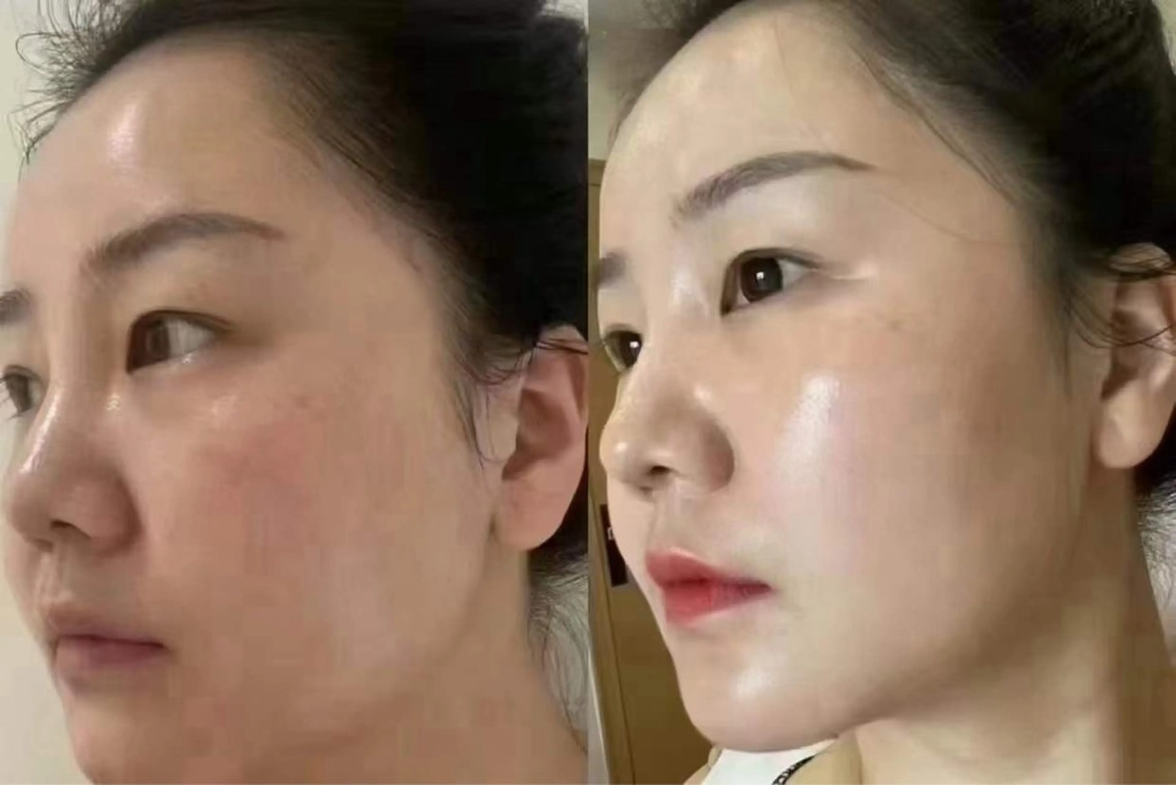 ネイル ブライダルネイル ホワイト エステ aliaハイフ&水光ジェットサロン所属・aliaハーブ水光店 エステティシャン募集のエステ・リラクイメージ