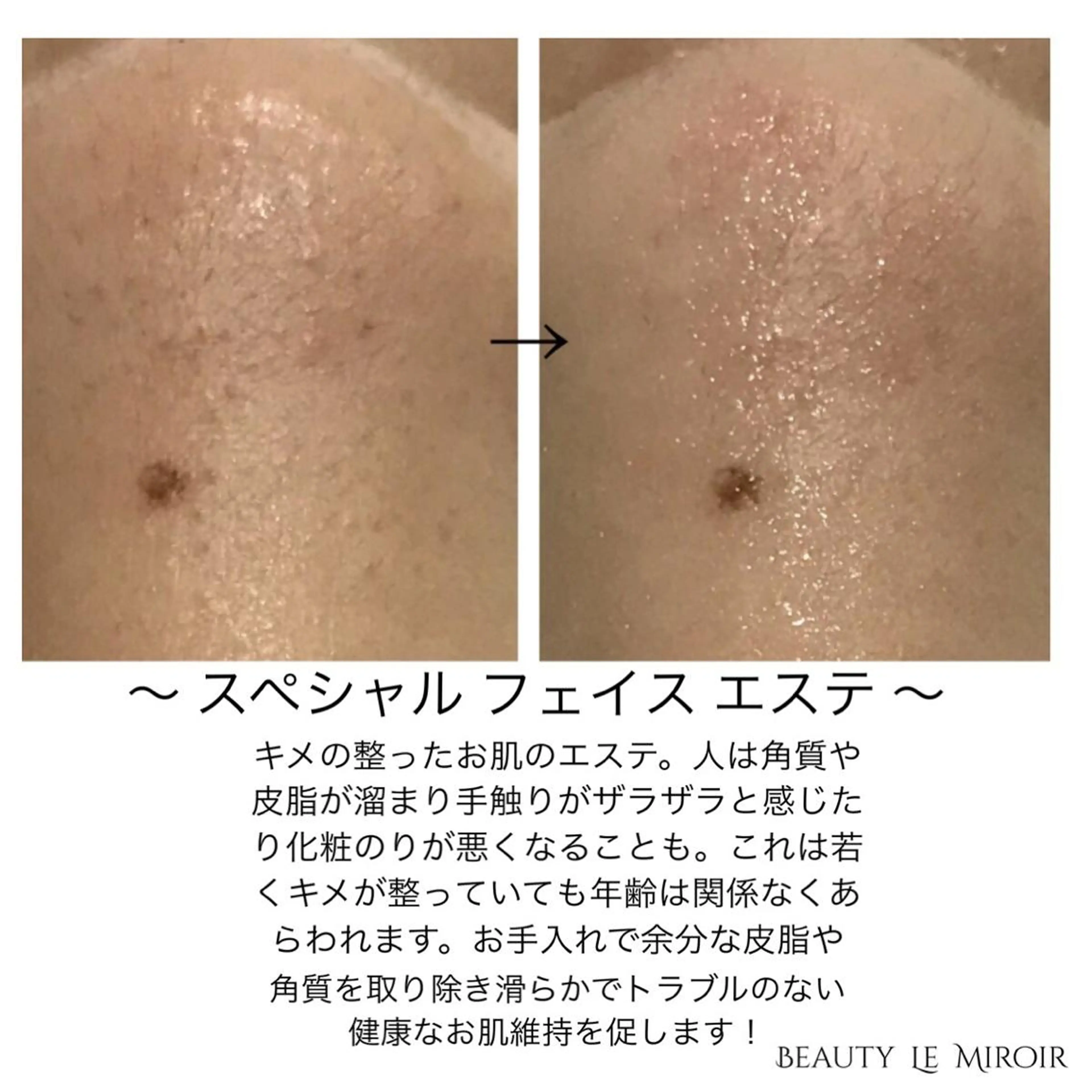 ビューティー ミロワールのエステ・リラクイメージ