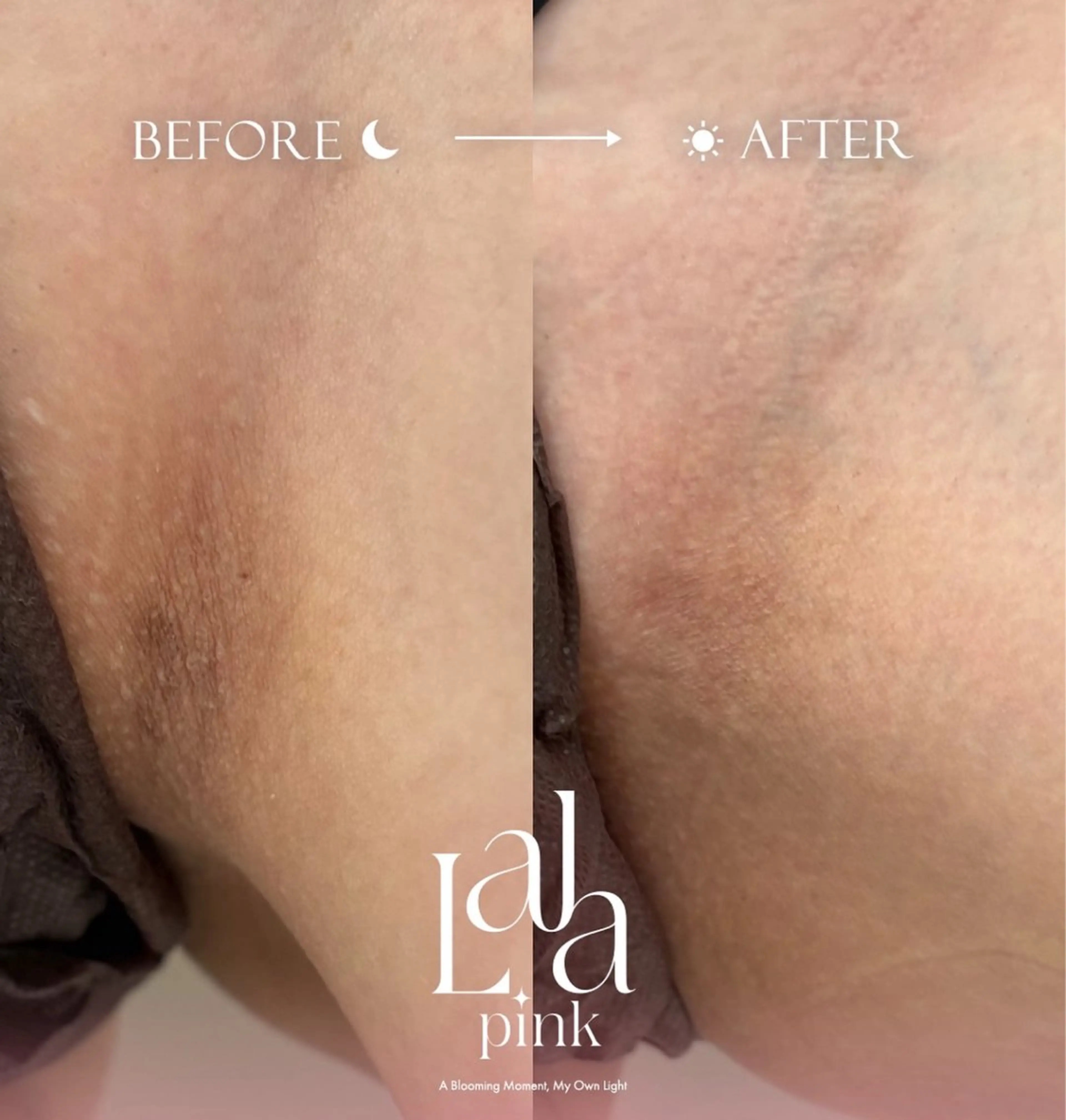 KIRAN 山﨑のエステ・リラクイメージ