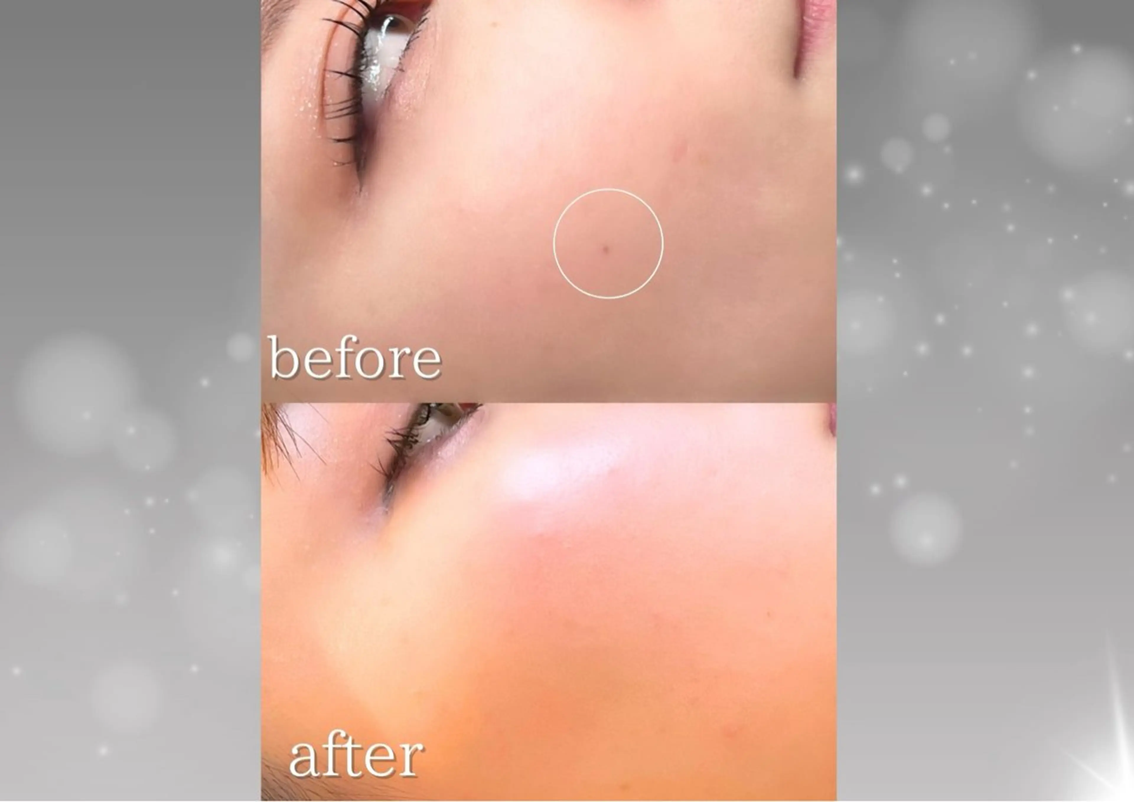 エステ 小顔/たるみ/黒ずみ除去専門サロン/SONA 大和西大寺店所属・【小顔専門看護師 サロンSONA】のエステ・リラクイメージ