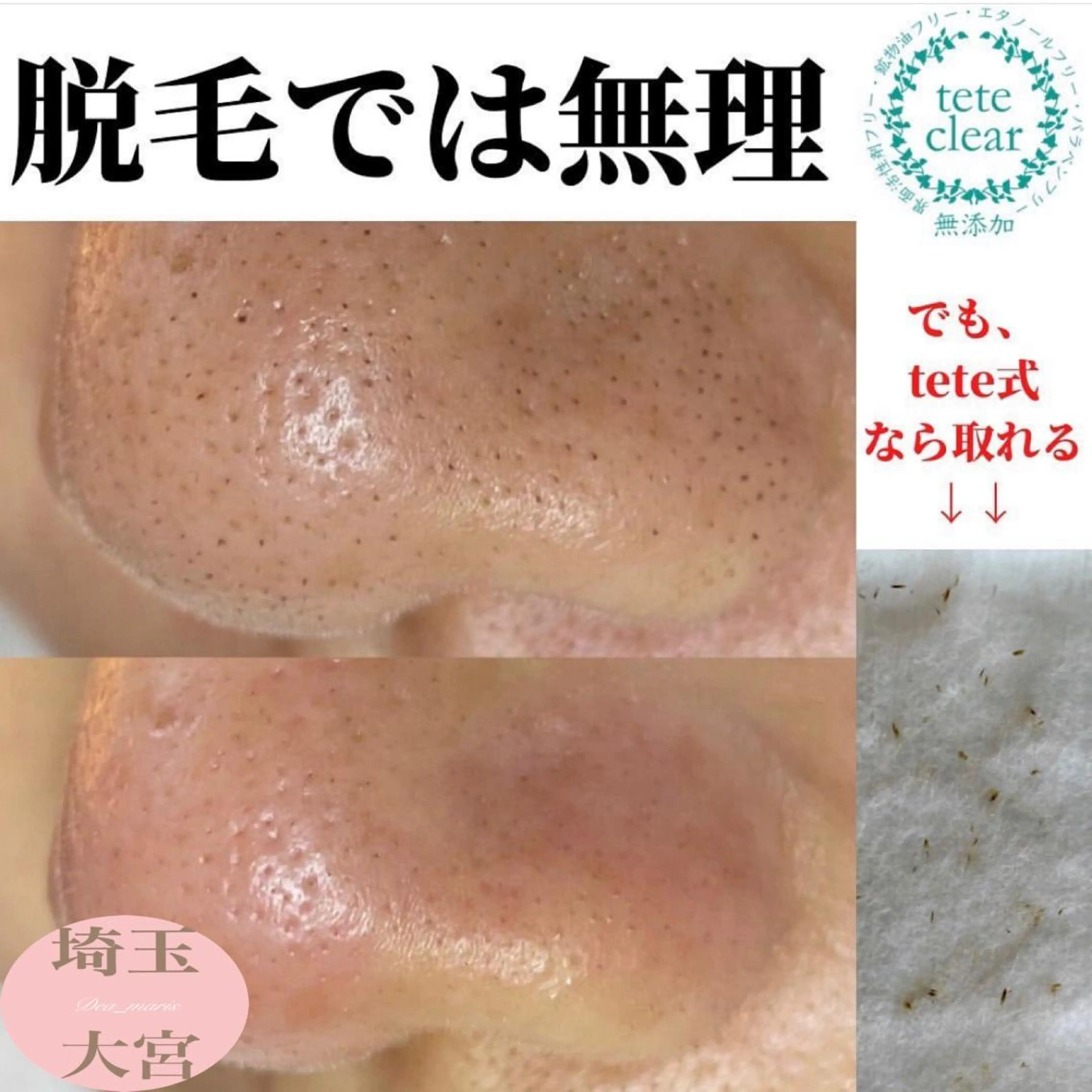 private salon  Dea_maris シュガーリング＆パーソナルボディケア所属・シミ改善・韓国肌管理 ボディメイク痩身のその他イメージ