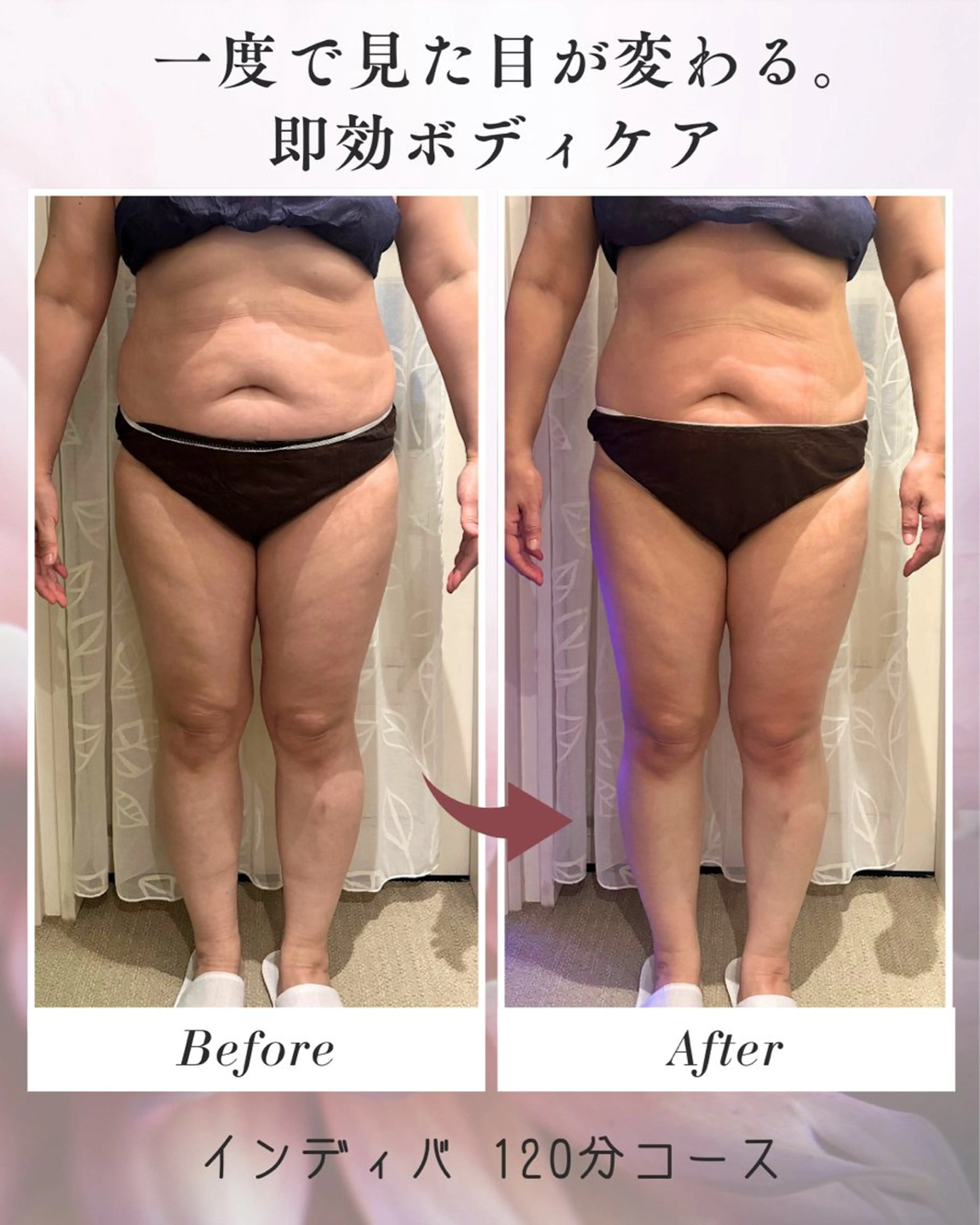 エステ リラク boju reborn所属・インディバ温活ケア 痩身ダウンタイム妊活のエステ・リラクイメージ