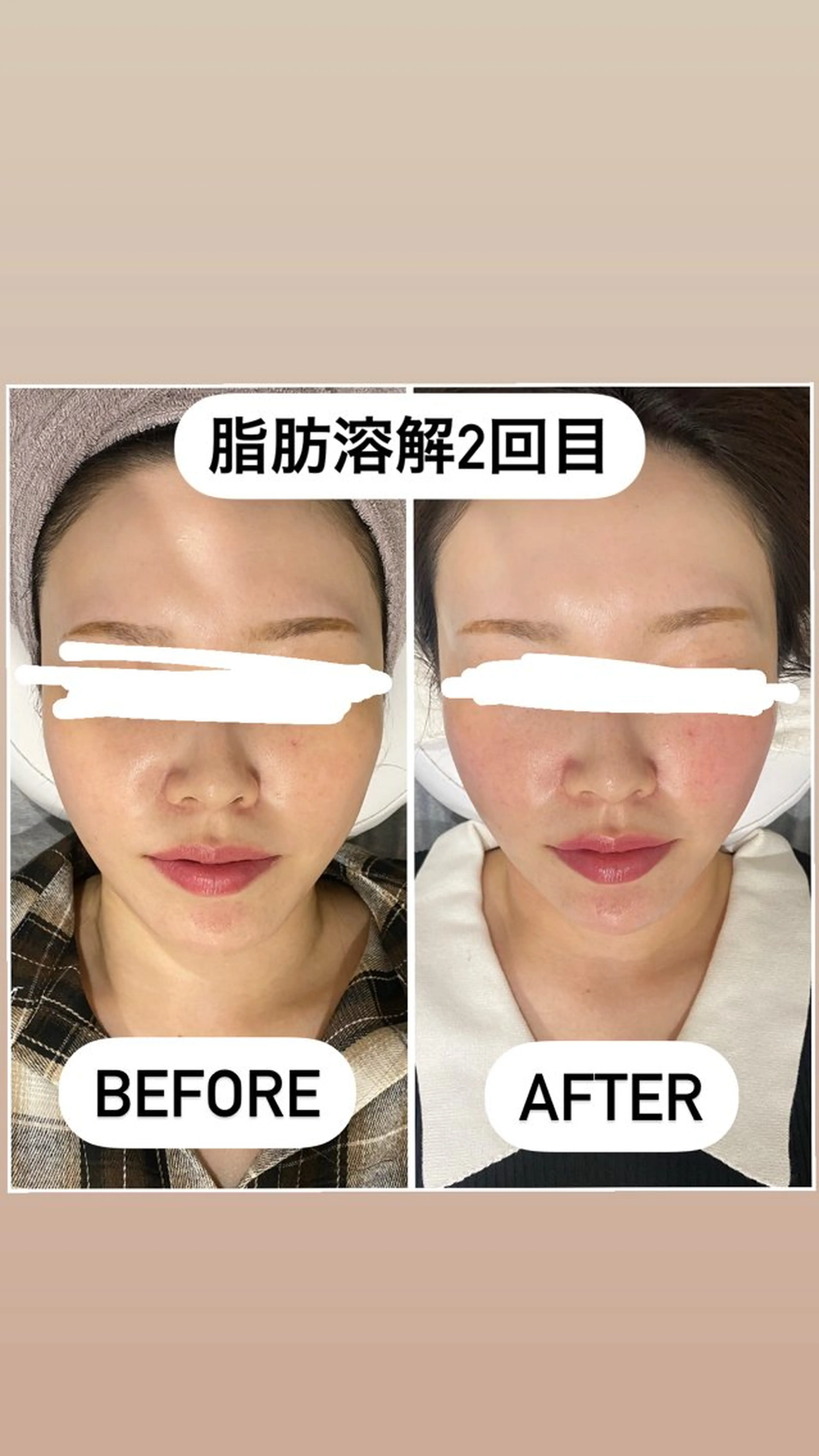 エステ 毛穴洗浄・痩身・脱毛 /アルカンジュのエステ・リラクイメージ