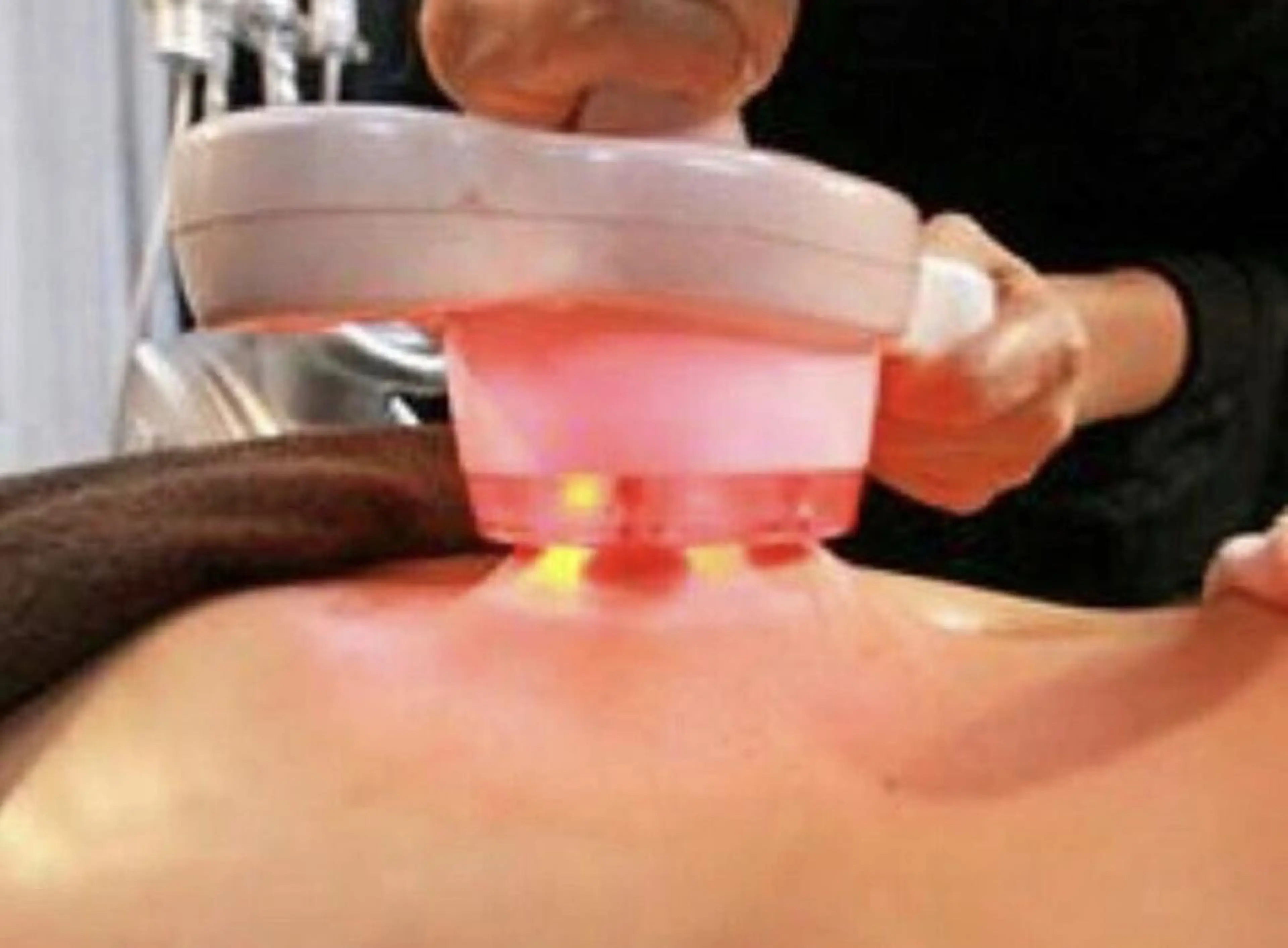 【No1痩身/美脚・おなか・くびれ・ヒップアップ等】キャビ×ラジオ波×クラッシュ×リンパ90分の写真