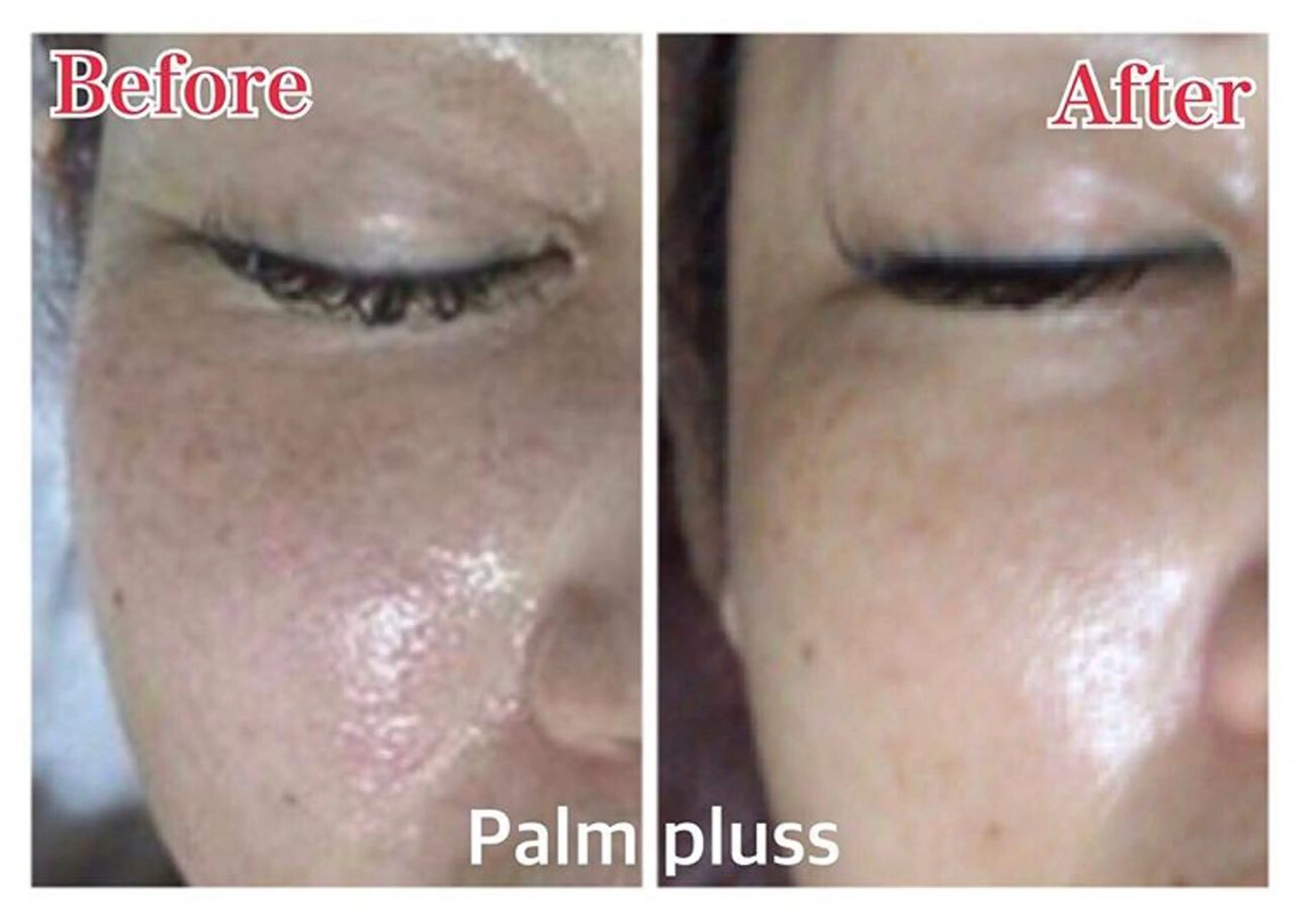 首肩こり専門サロン Kalnicco/カルニッコ所属・首肩こり専門サロン Kalniccoのエステ・リラクイメージ