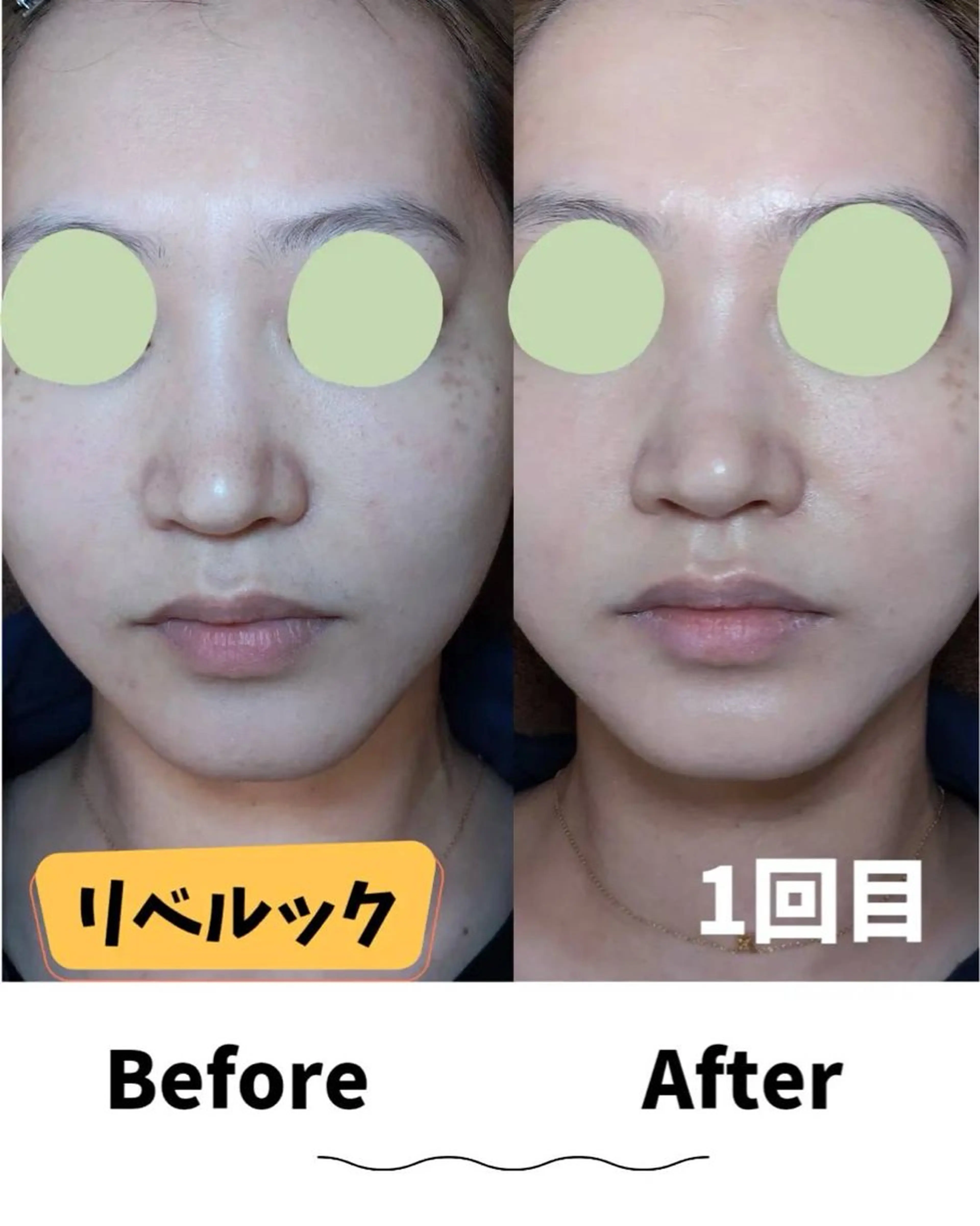 エステ コンセプトサロン友 木下のエステ・リラクイメージ