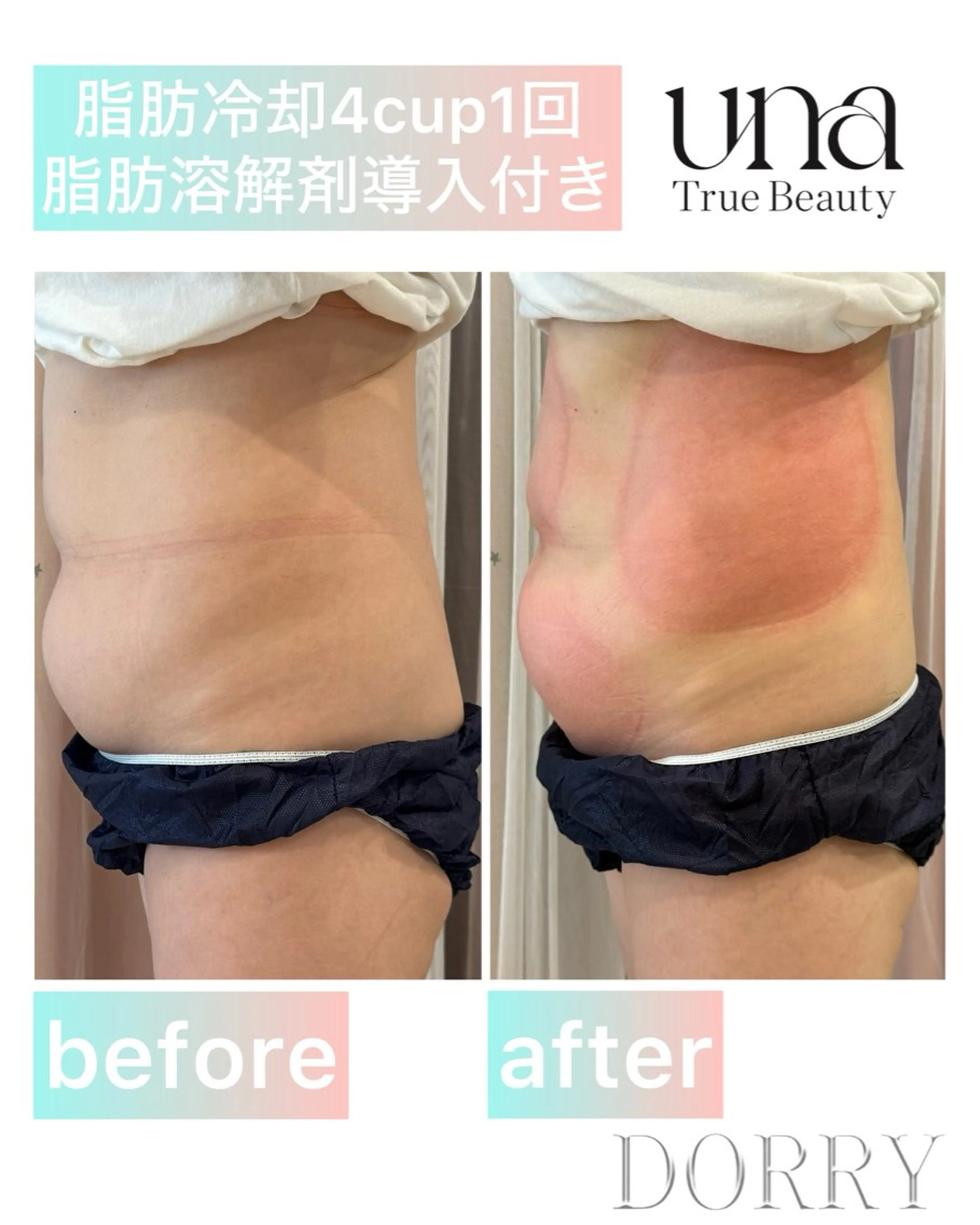 脂肪冷却サロンUNA SHIROKANEのその他イメージ