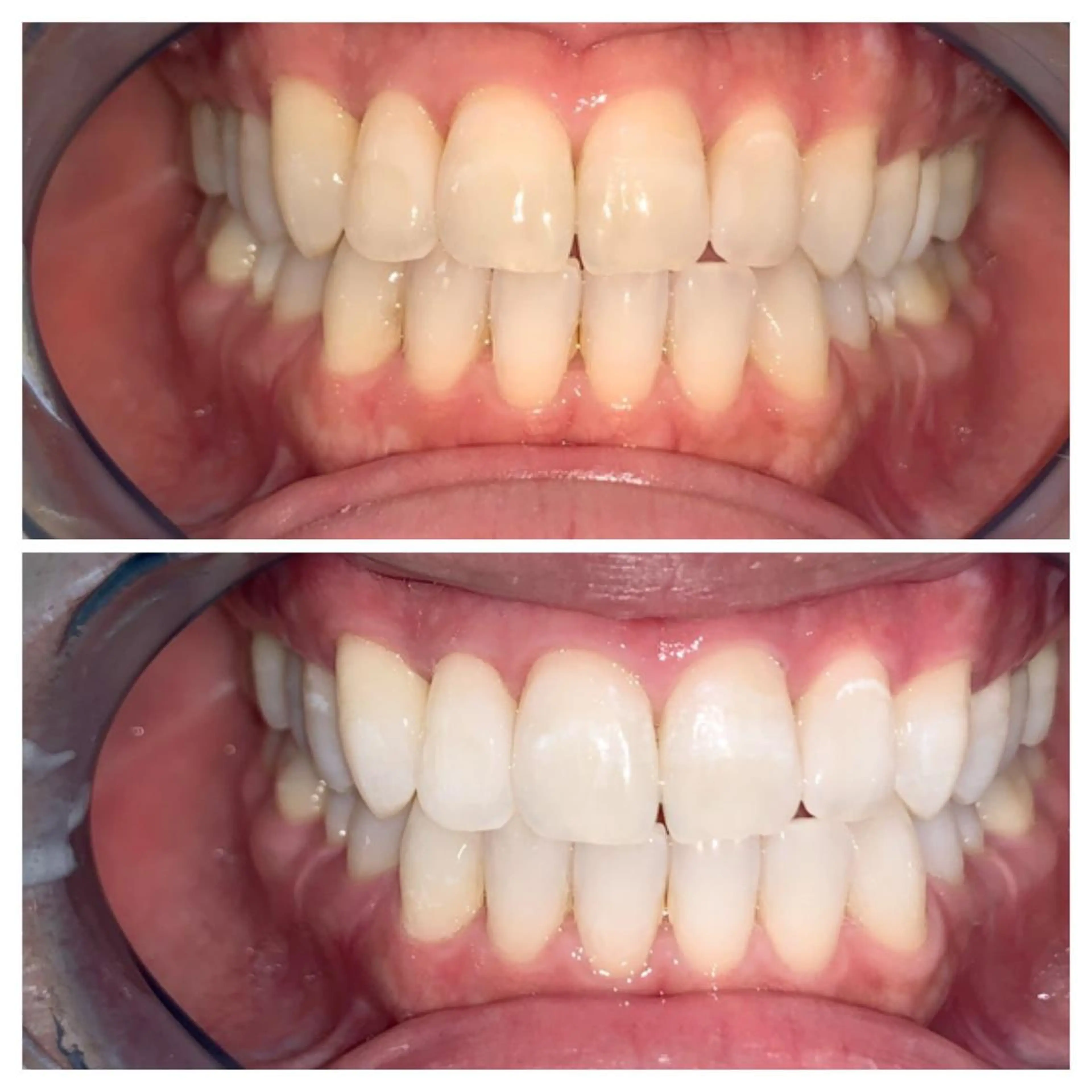 ネイル ヘアアレンジ ロング カラー メンズ マツエク・マツパ アイブロウ キッズ パーマ エステ リラク ライトビューティー 銀座店のエステ・リラクイメージ