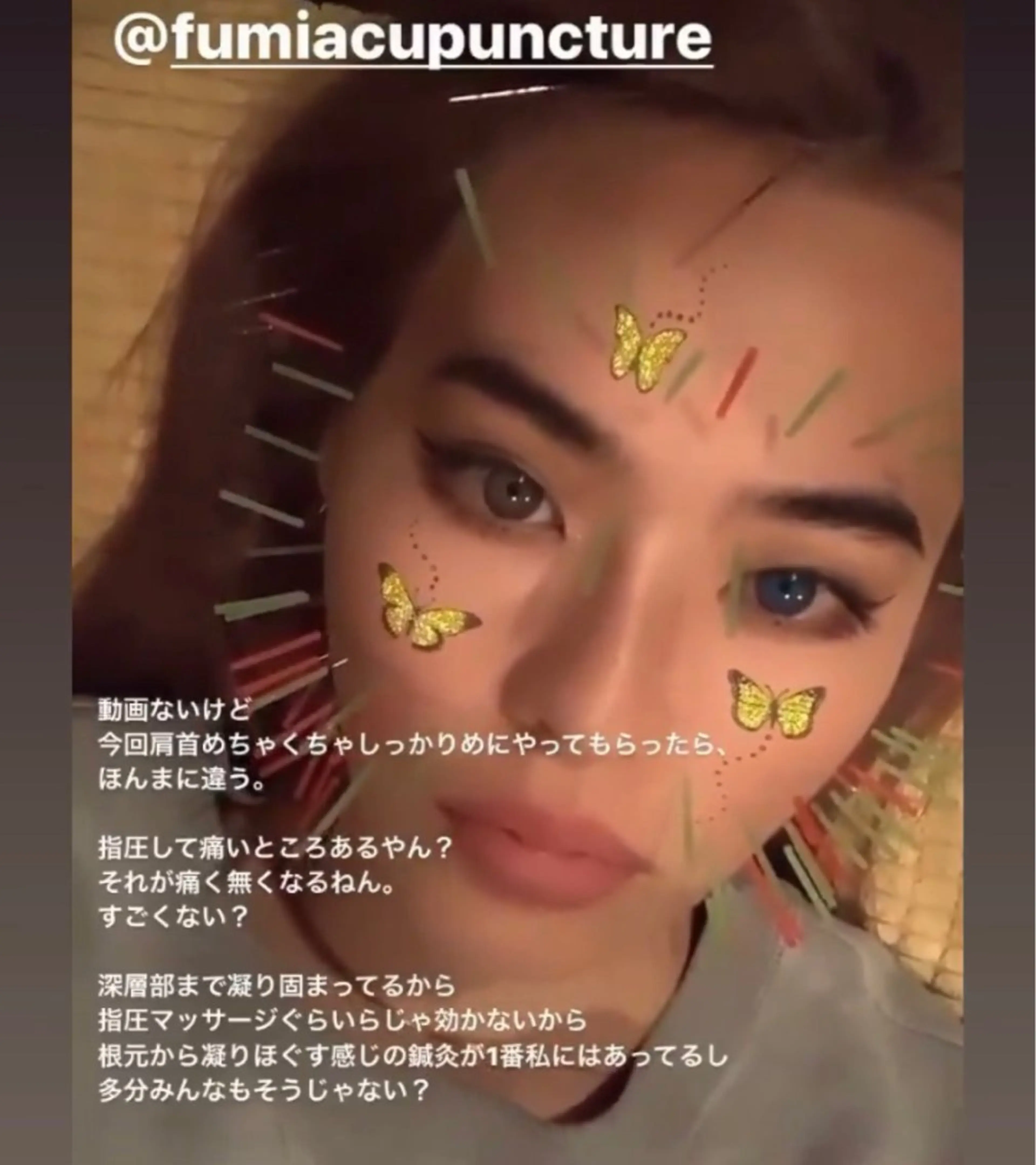 THE  ROOTS所属・美容鍼♡小顔矯正♡ fumikaのエステ・リラクイメージ