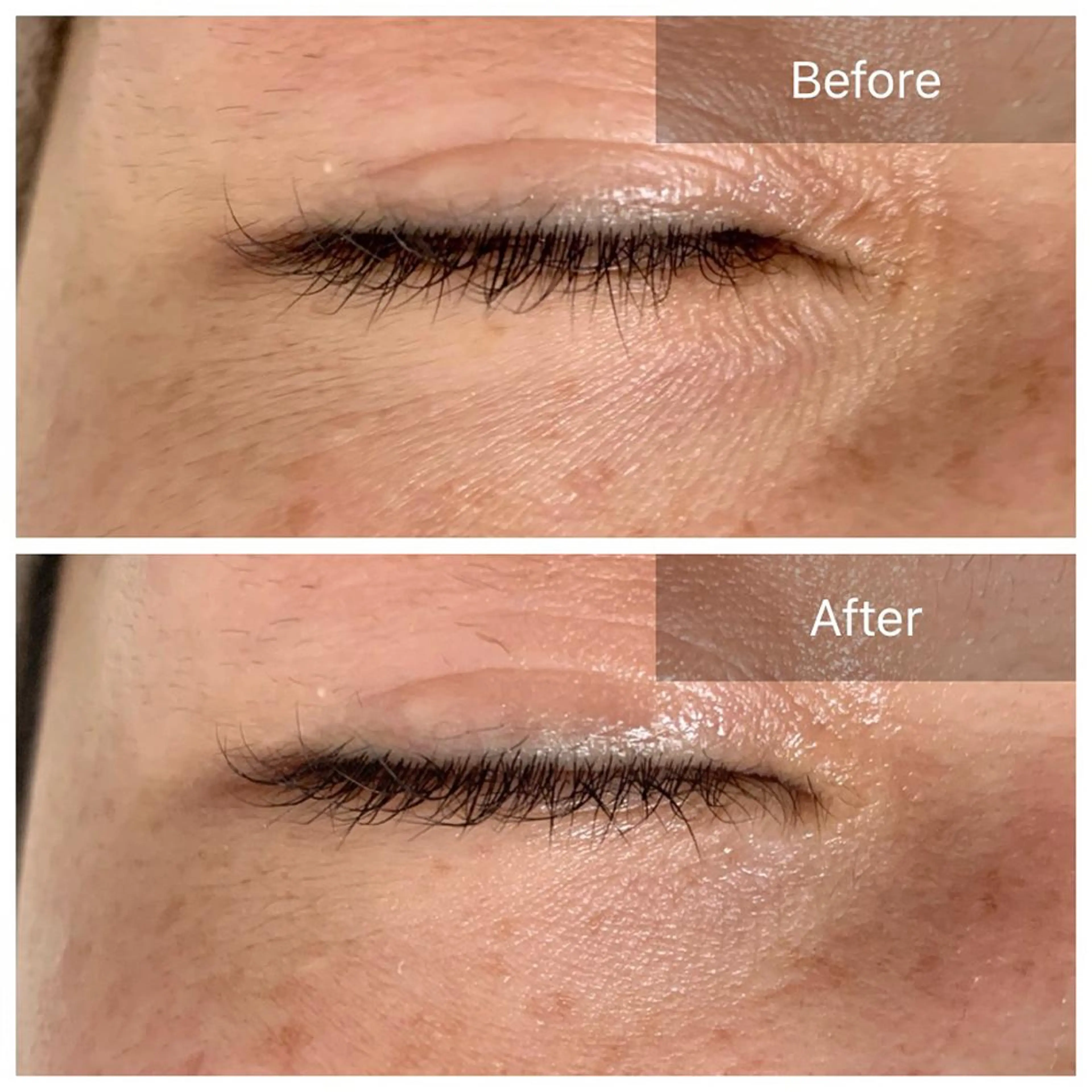 エステ Charis エステ&ネイルのエステ・リラクイメージ