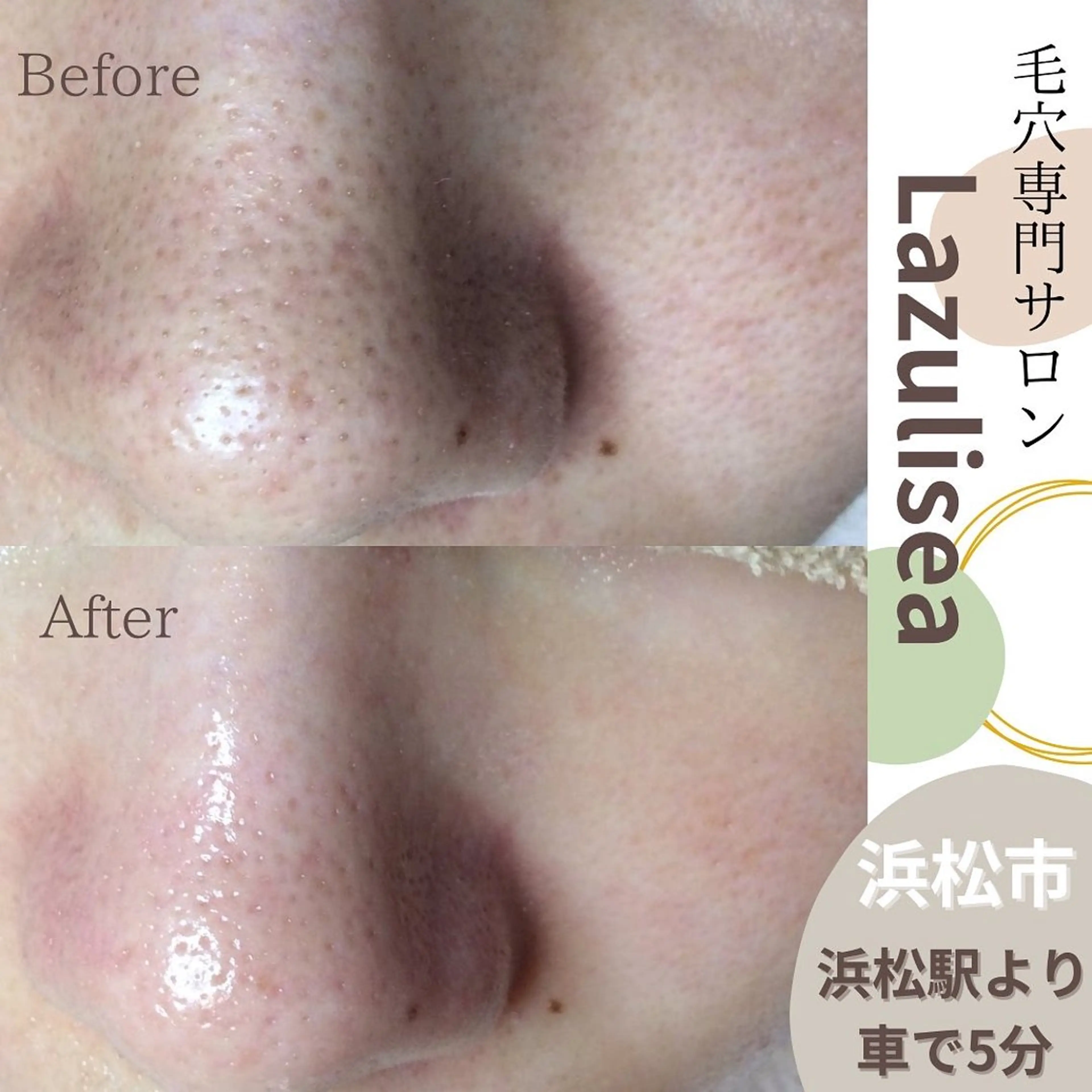 エステ エステサロン Lazulisea所属・川口 春奈のエステ・リラクイメージ