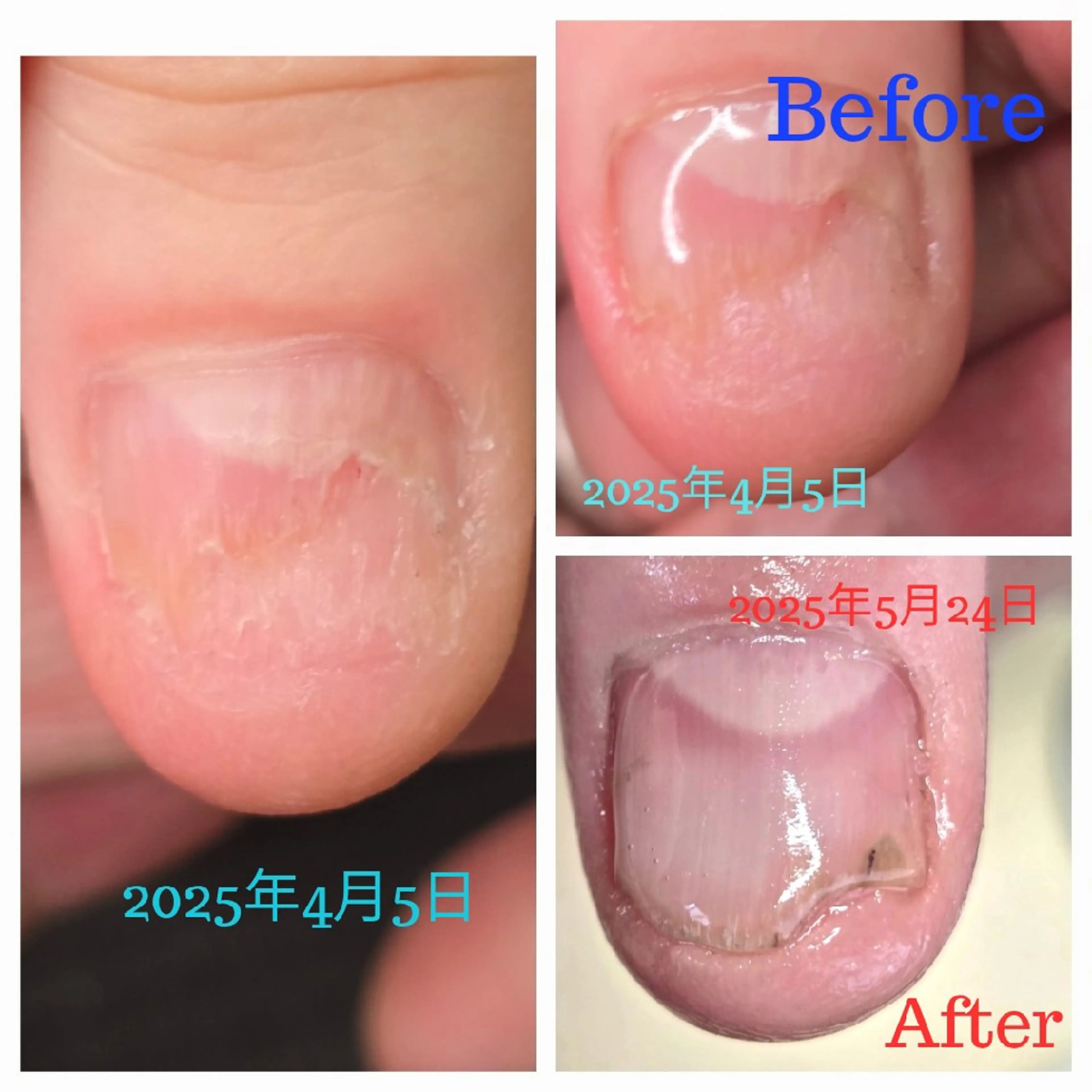 ネイル minion蕨所属・minion 蕨のネイルデザイン