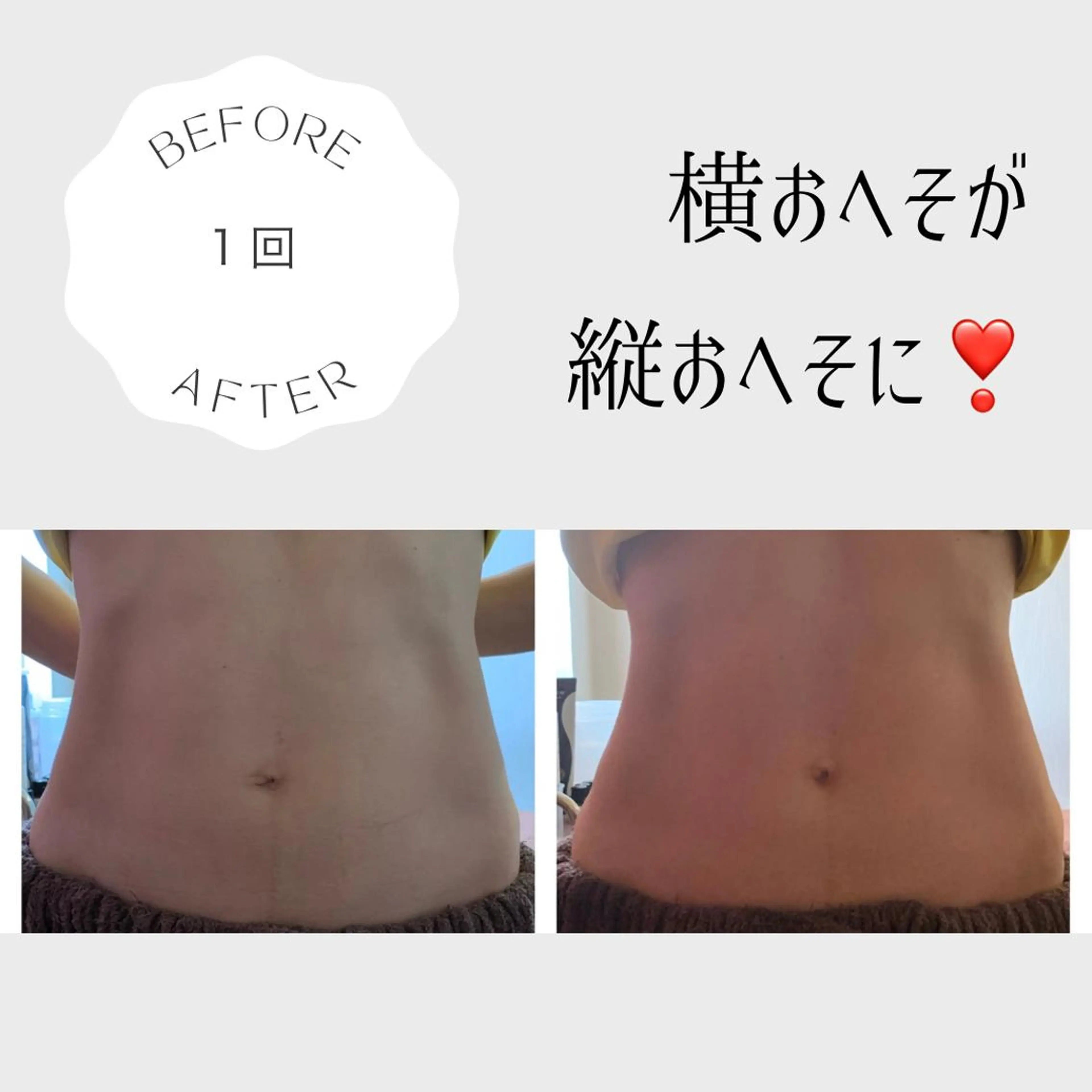 下半身のだるさに！✨腸もみ＋下半身リンパ✨ 腸もみに下半身のリンパマッサージがついたコース！老廃物を出しやすい体に♡の写真