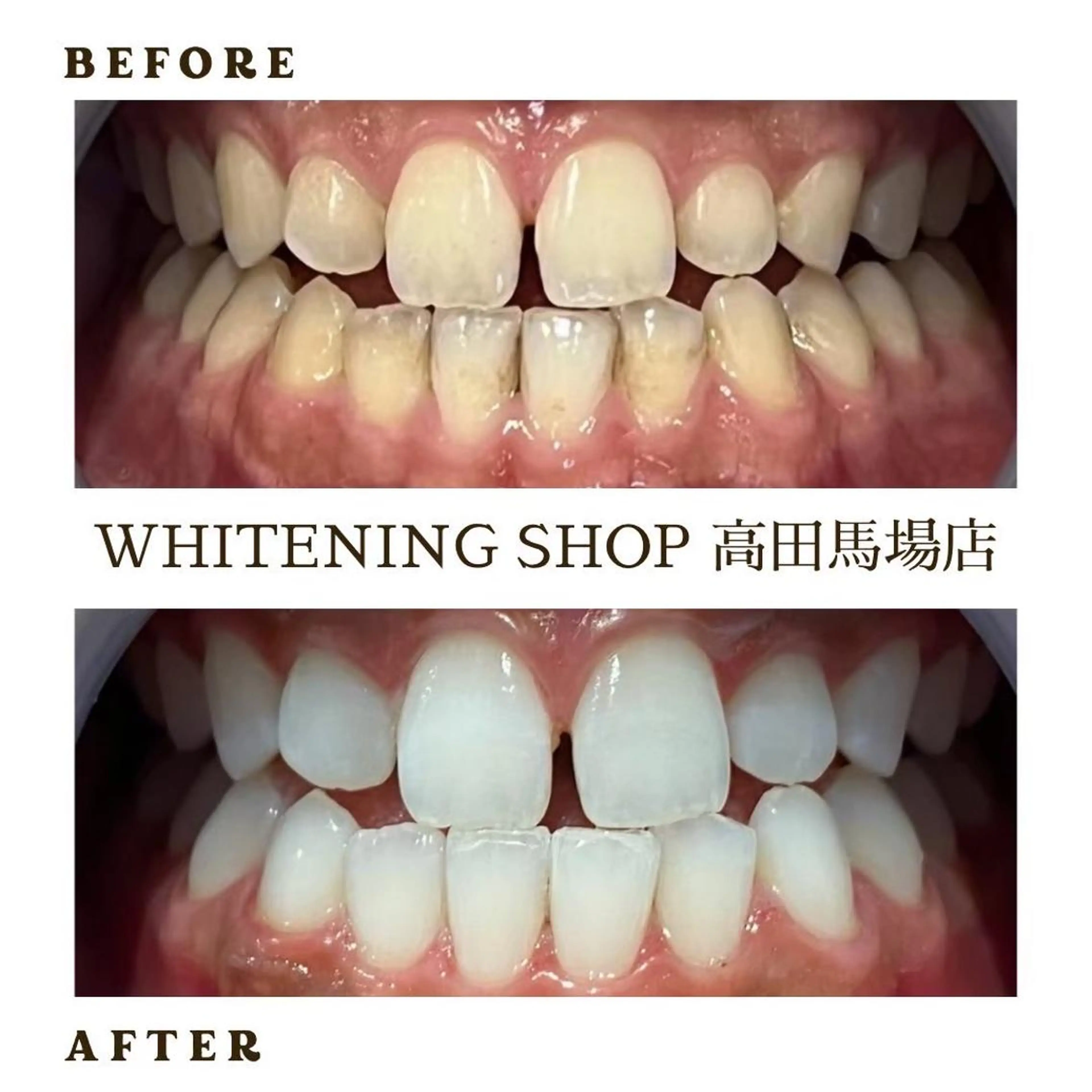 メンズ その他 ホワイトニング ショップ高田馬場店のその他イメージ
