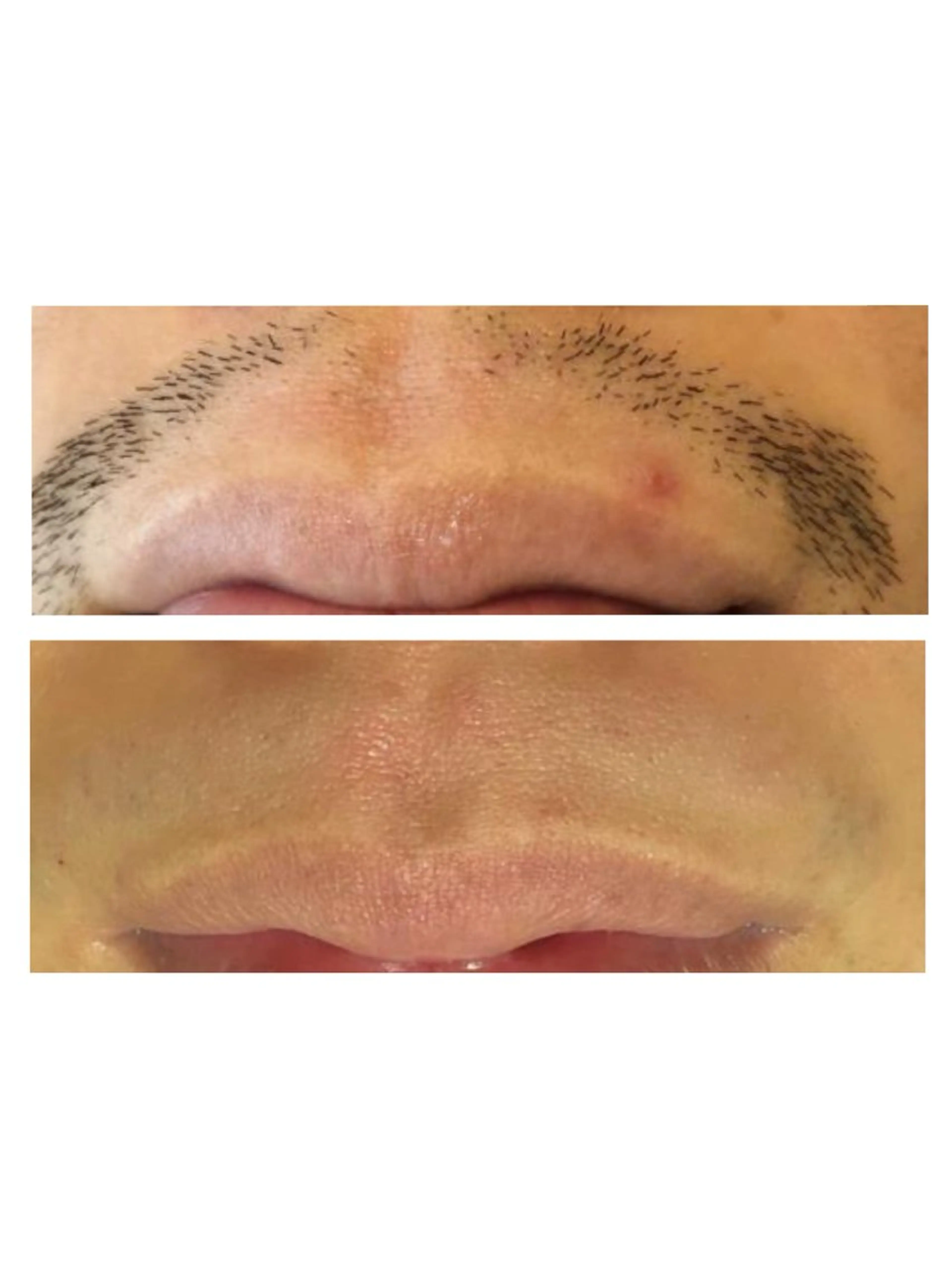 メンズ 脱毛 sourire麻布十番店所属・sourire スリールのエステ・リラクイメージ