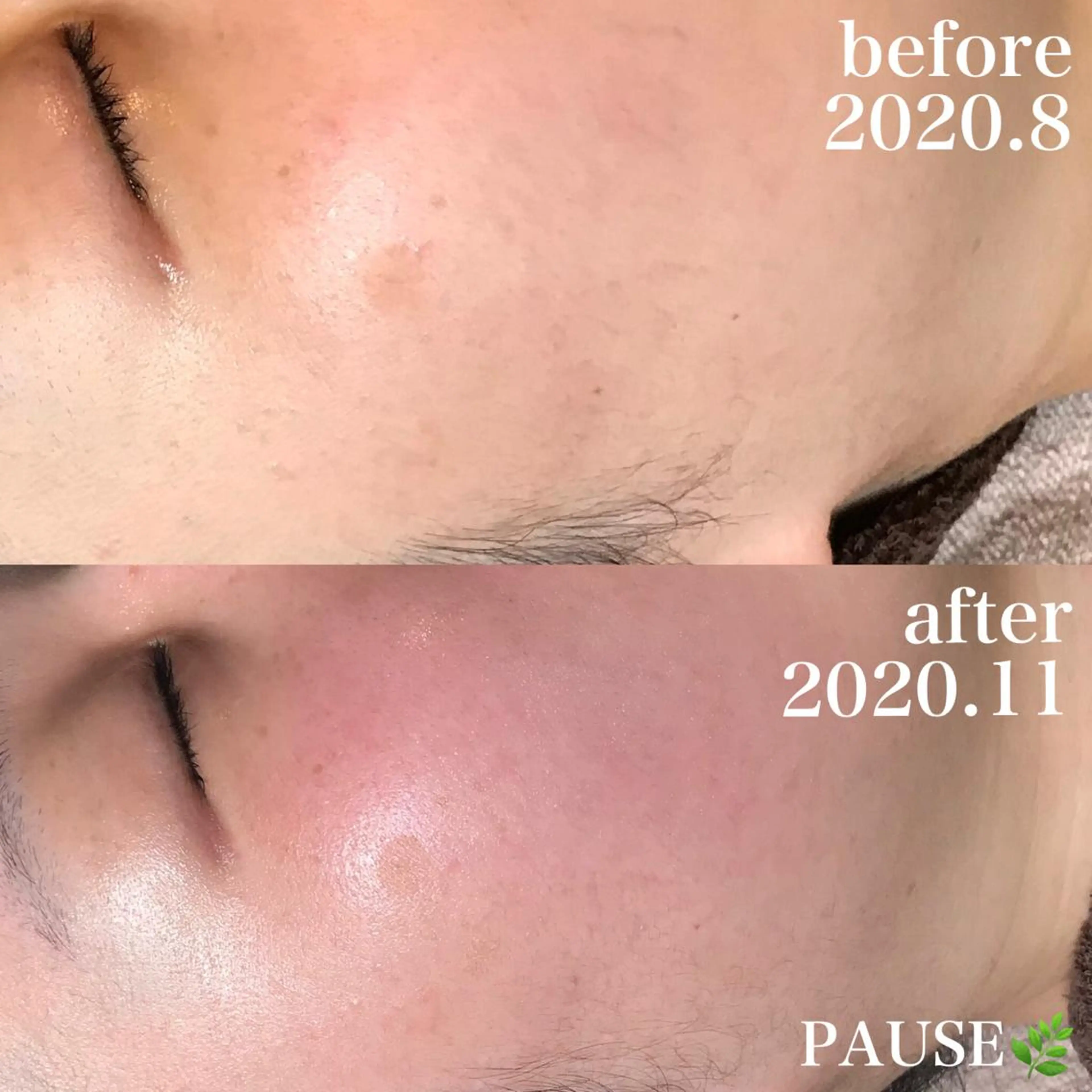 エステ 浜野 恵美のエステ・リラクイメージ