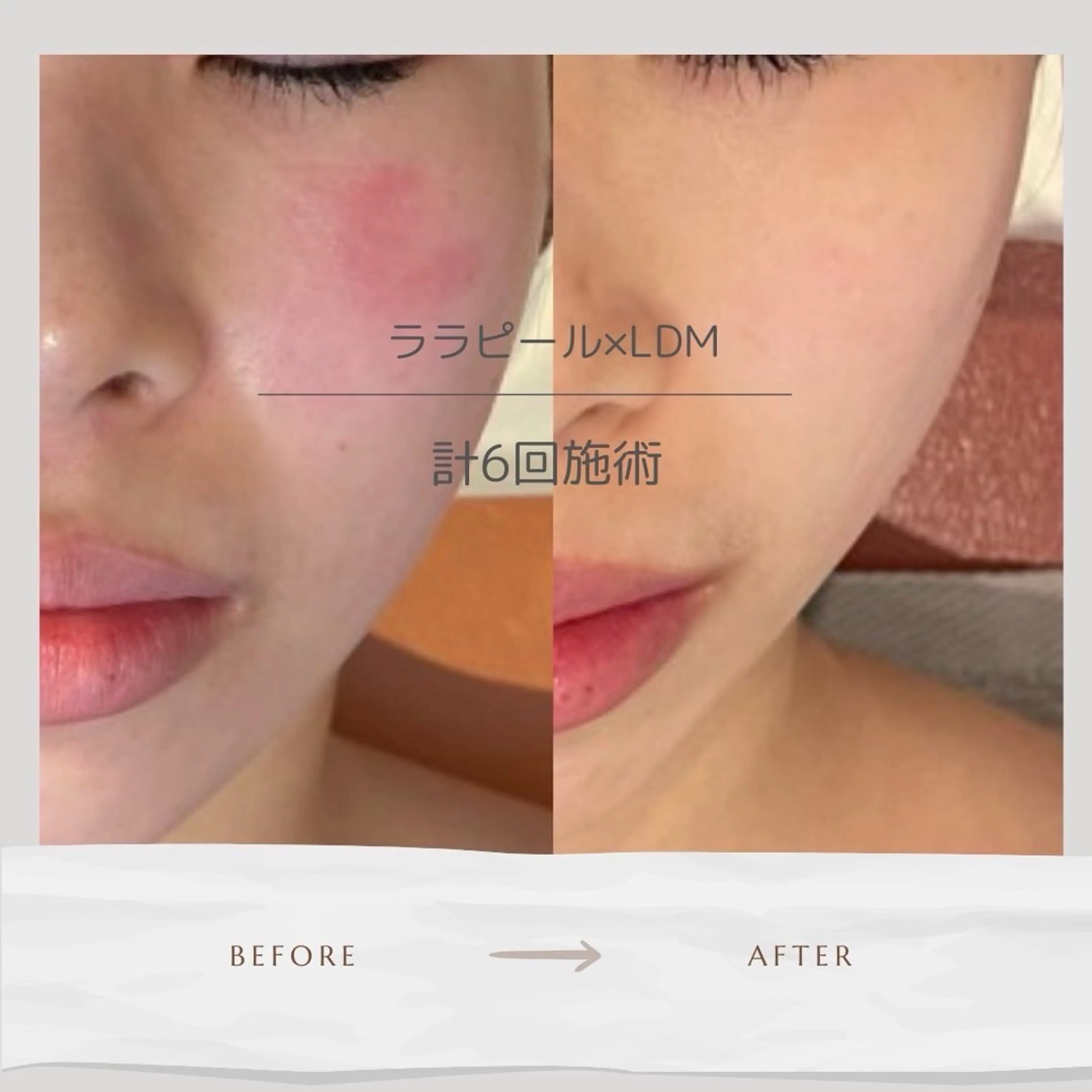 Smile beauty labのエステ・リラクイメージ