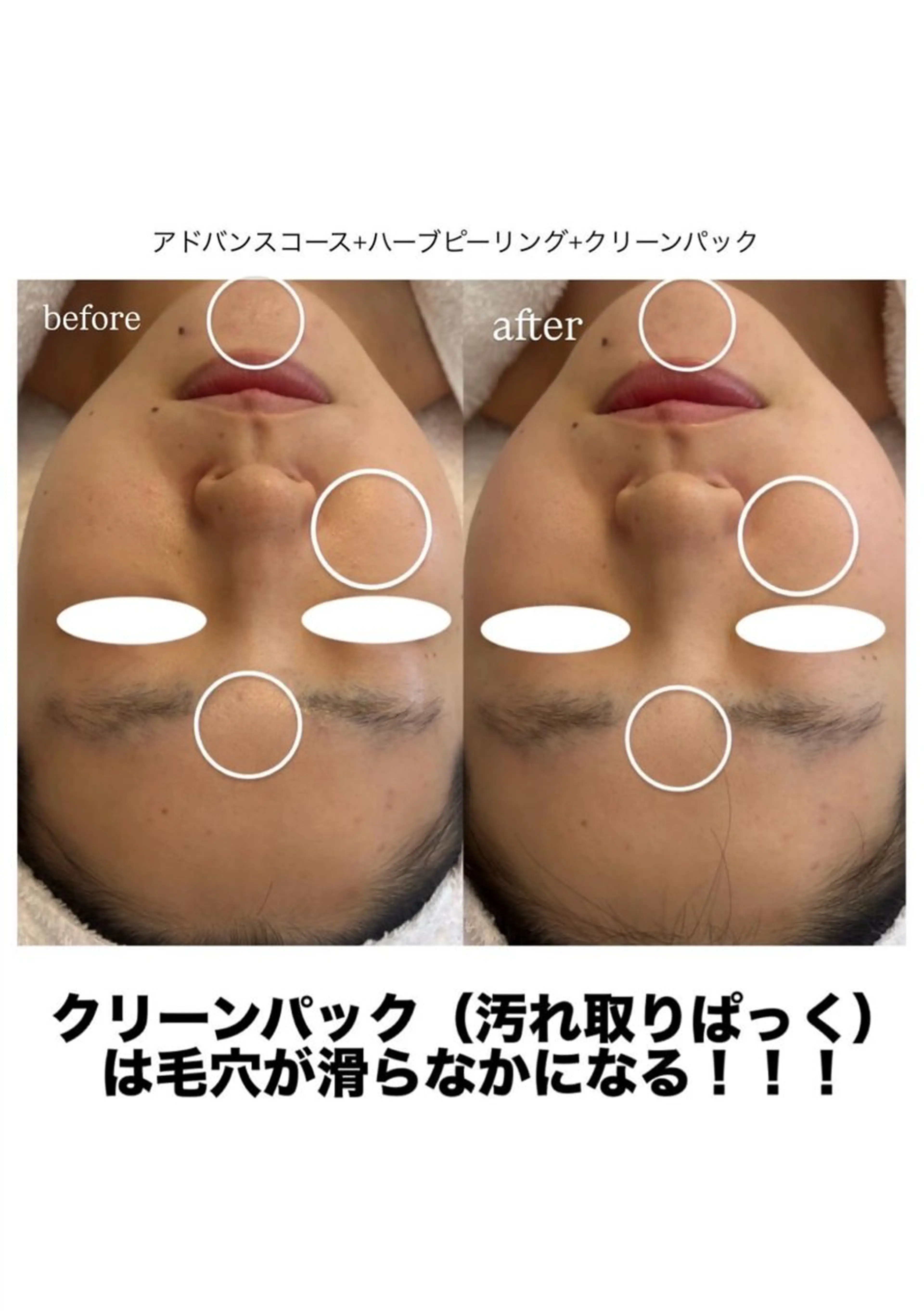 エステ メナードフェイシャルサロン　熊本インター西店所属・メナード MIYUのその他イメージ