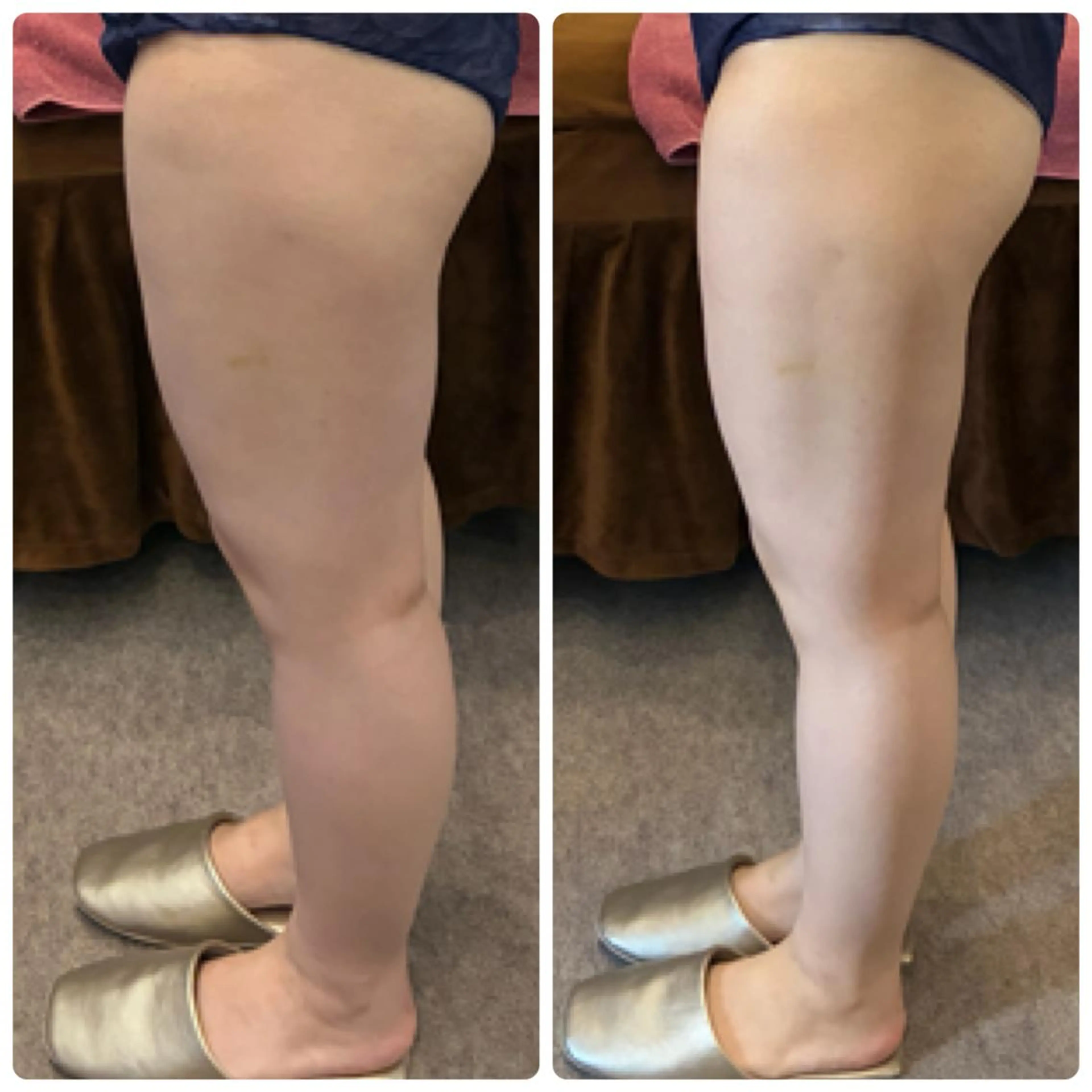 FLEURフェイシャ ル🫧ハーブ🌿小顔のエステ・リラクイメージ