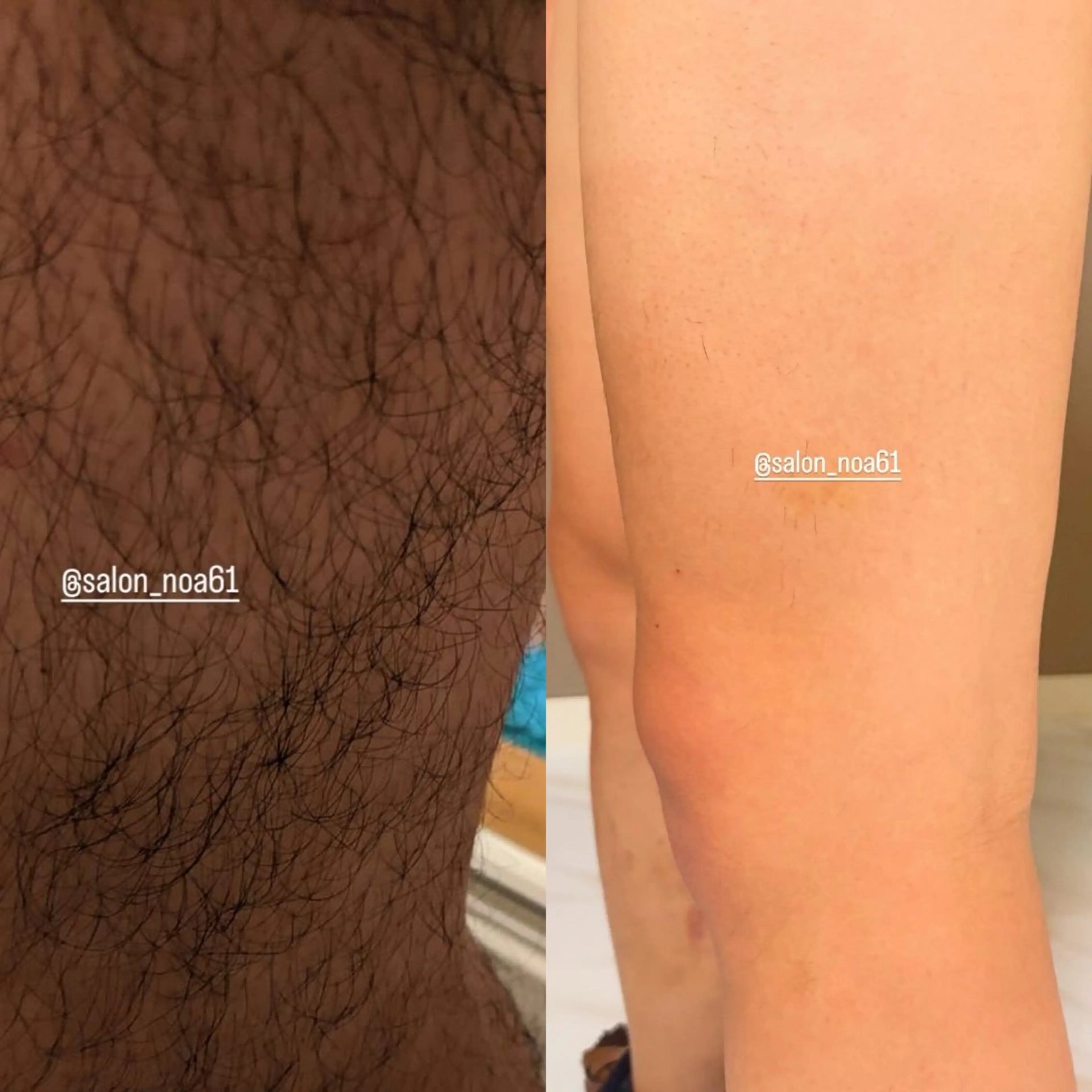 メンズ salon NOA所属・脱毛・ﾌｪｲｼｬﾙ 眉毛/山崎のエステ・リラクイメージ