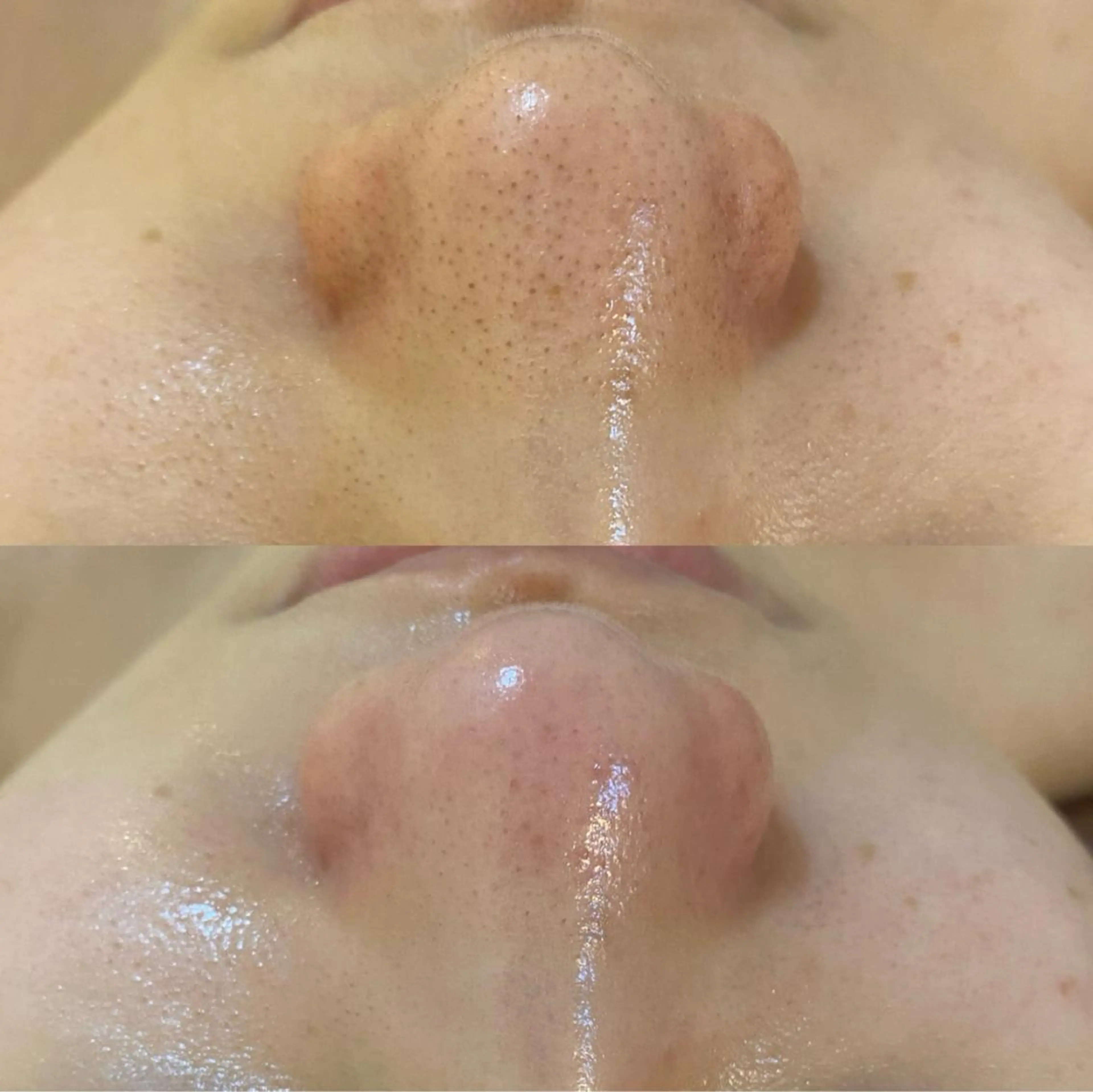 エステ リラク BELCIA福岡店　récolte de BELCIA（レコルトデベルシア）所属・BELCIA福岡店 レコルトデベルシアのエステ・リラクイメージ