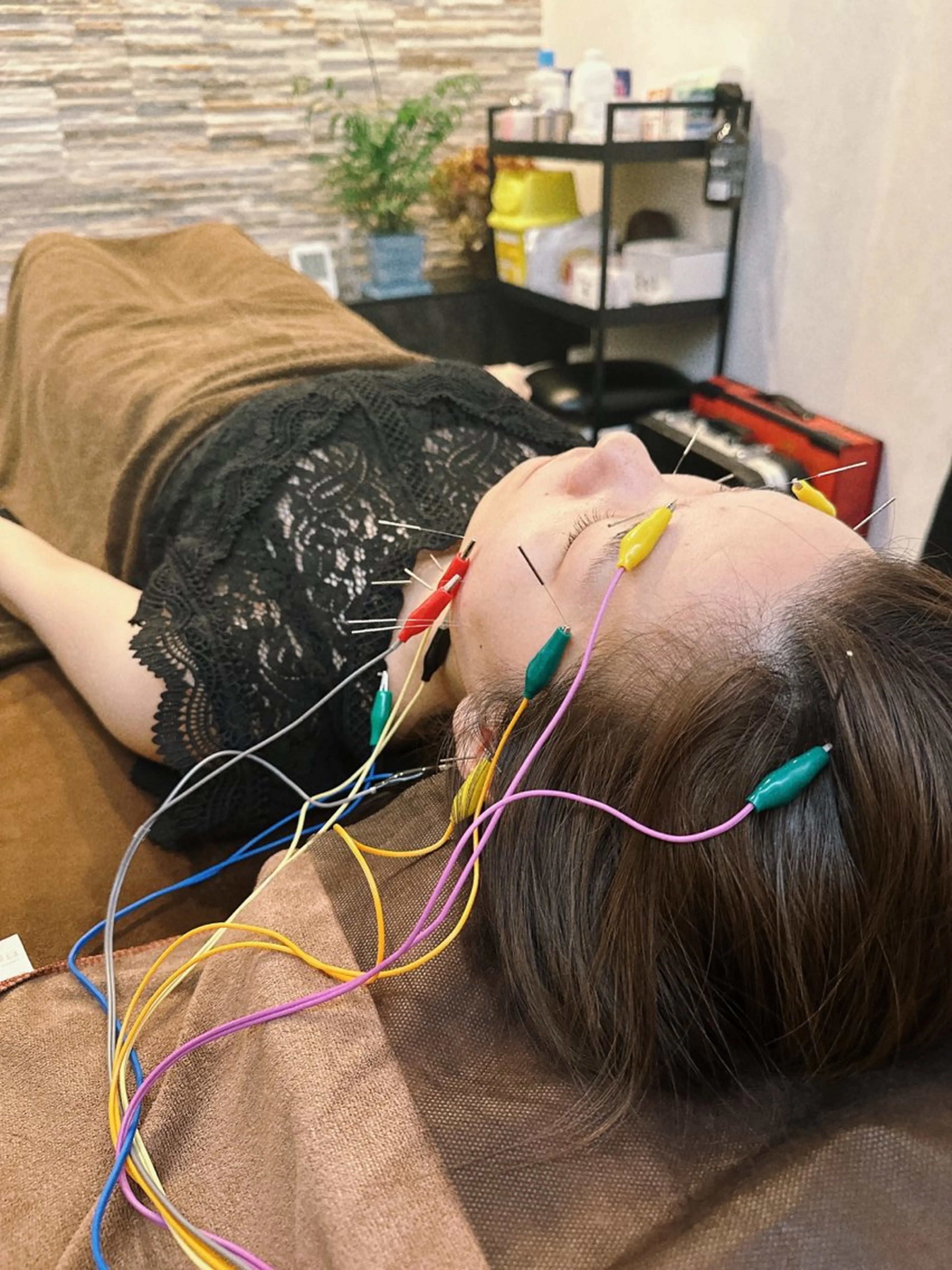 その他 美容鍼灸整体サロンBeauJu所属・小顔矯/美容鍼/鍼灸 BeauJuのその他イメージ